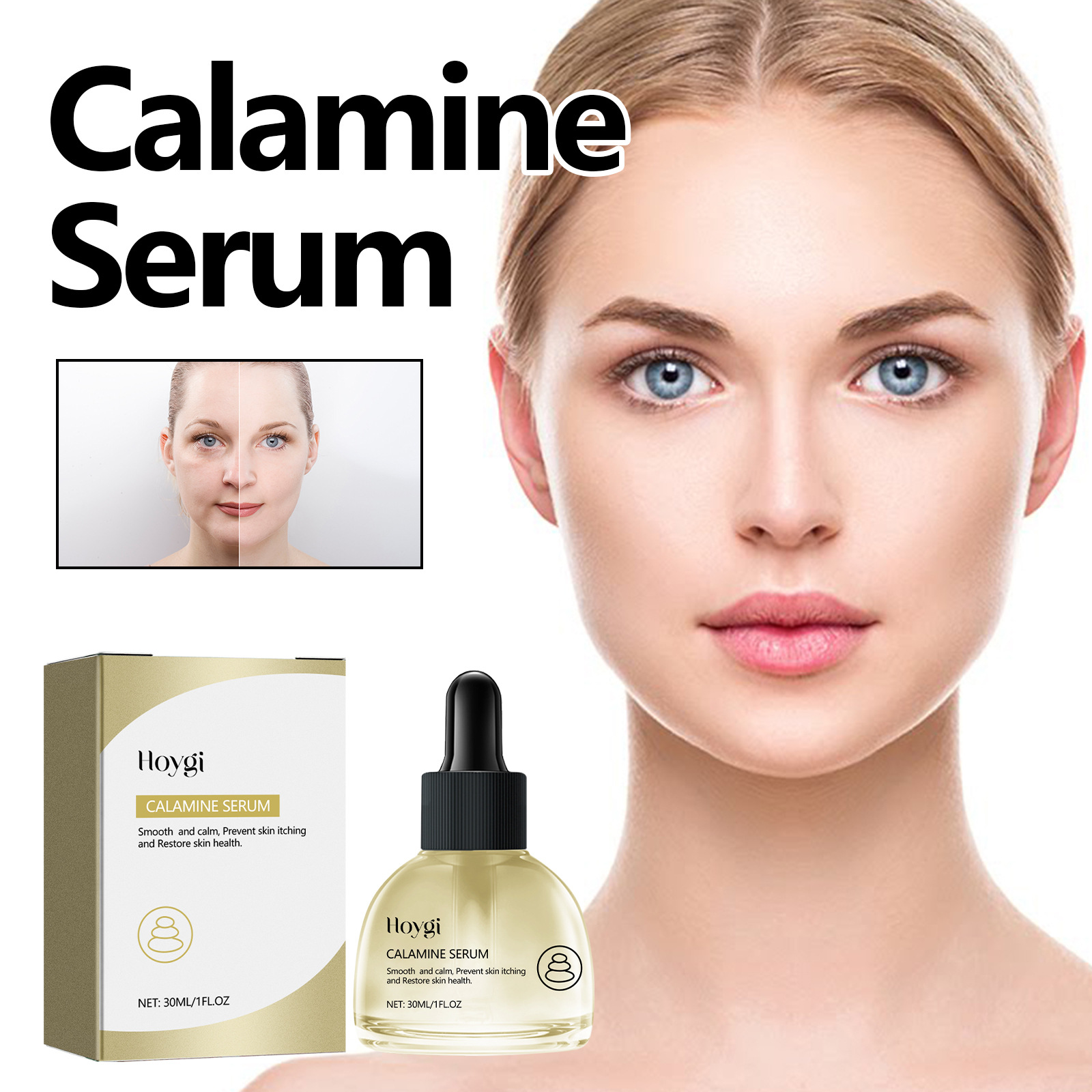 Hoygi calamine facial essence improves dryness, dullness, skin acne, moisturizes and plumps_voghion.com