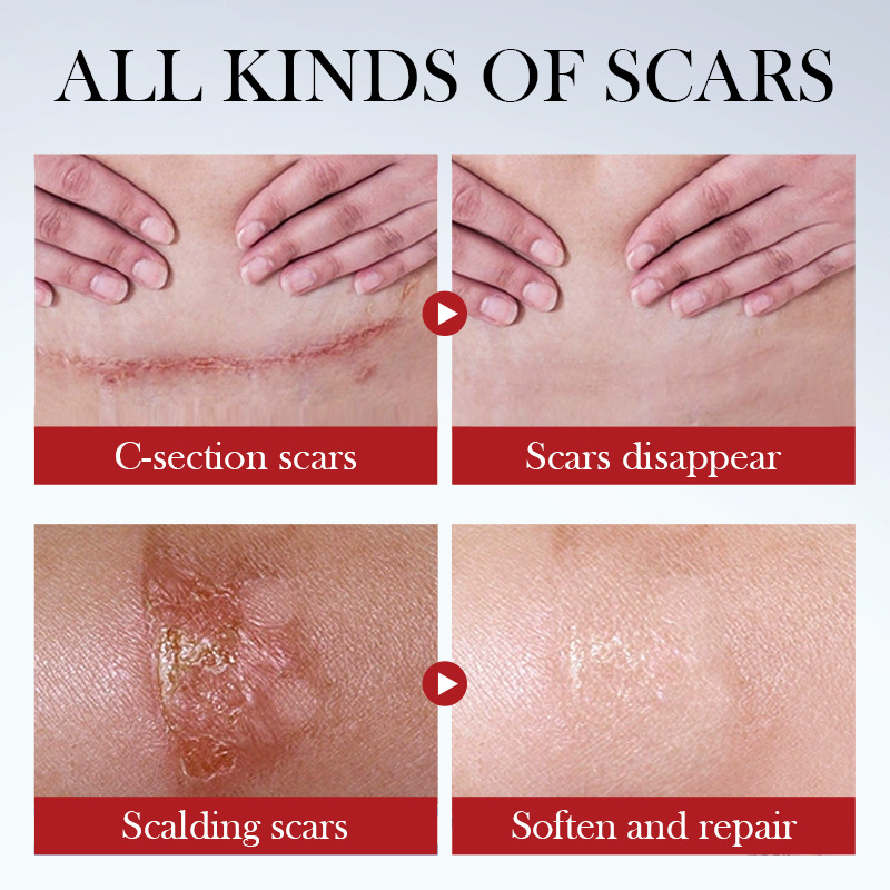 All English Sadoer Repair Cream Repariert Verbrühungsnarben Feuchtigkeitsspendende und verjüngende Gesichtscreme_voghion.com