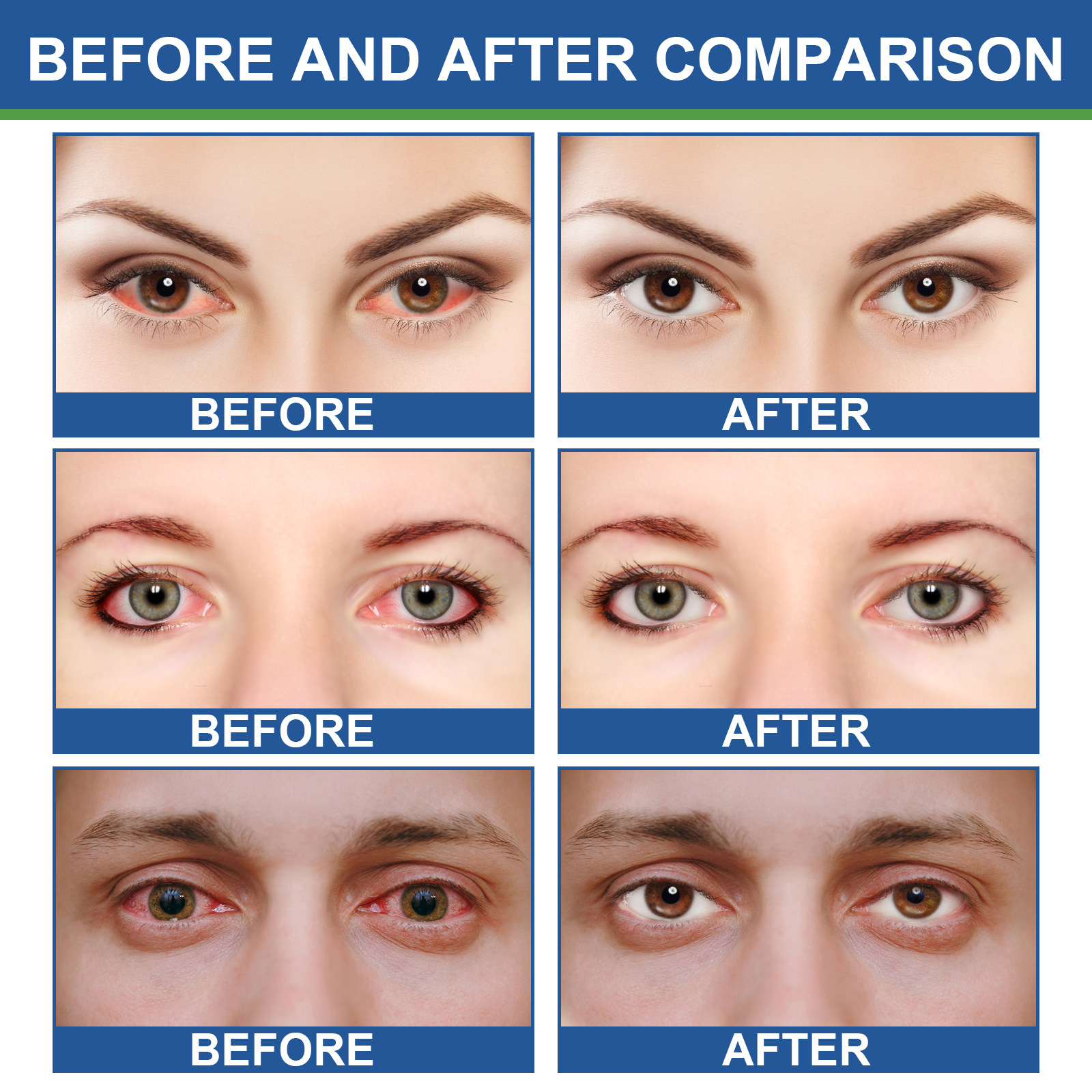 Crema hidratante suave para el contorno de ojos South Moon Repairs Pain, Fatiga, Sequedad y Luminosidad_voghion.com