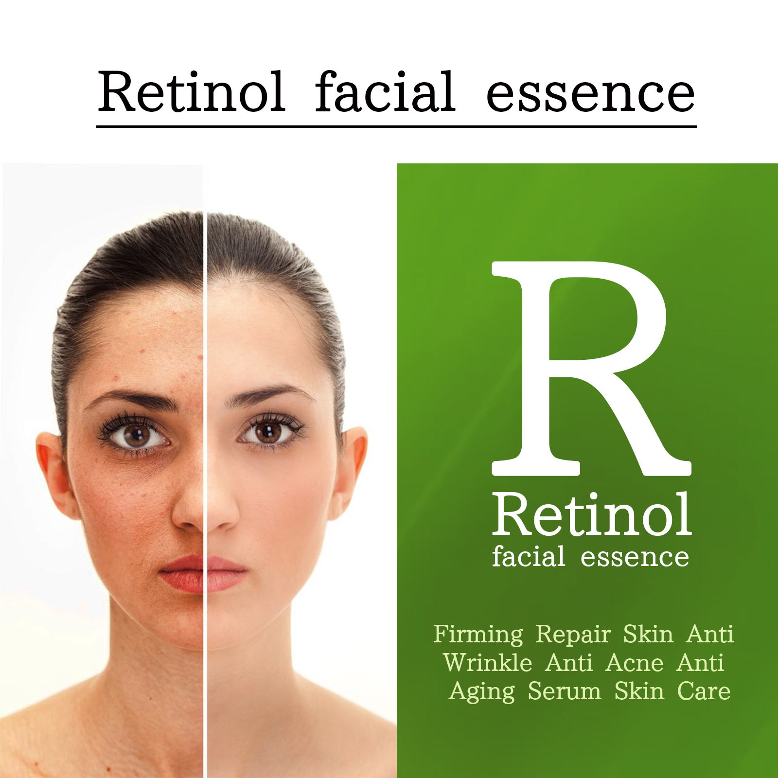 OUHOE Essenza di retinolo Antirughe, rassodante, illuminante e riparatrice delle linee sottili intorno agli occhi_voghion.com