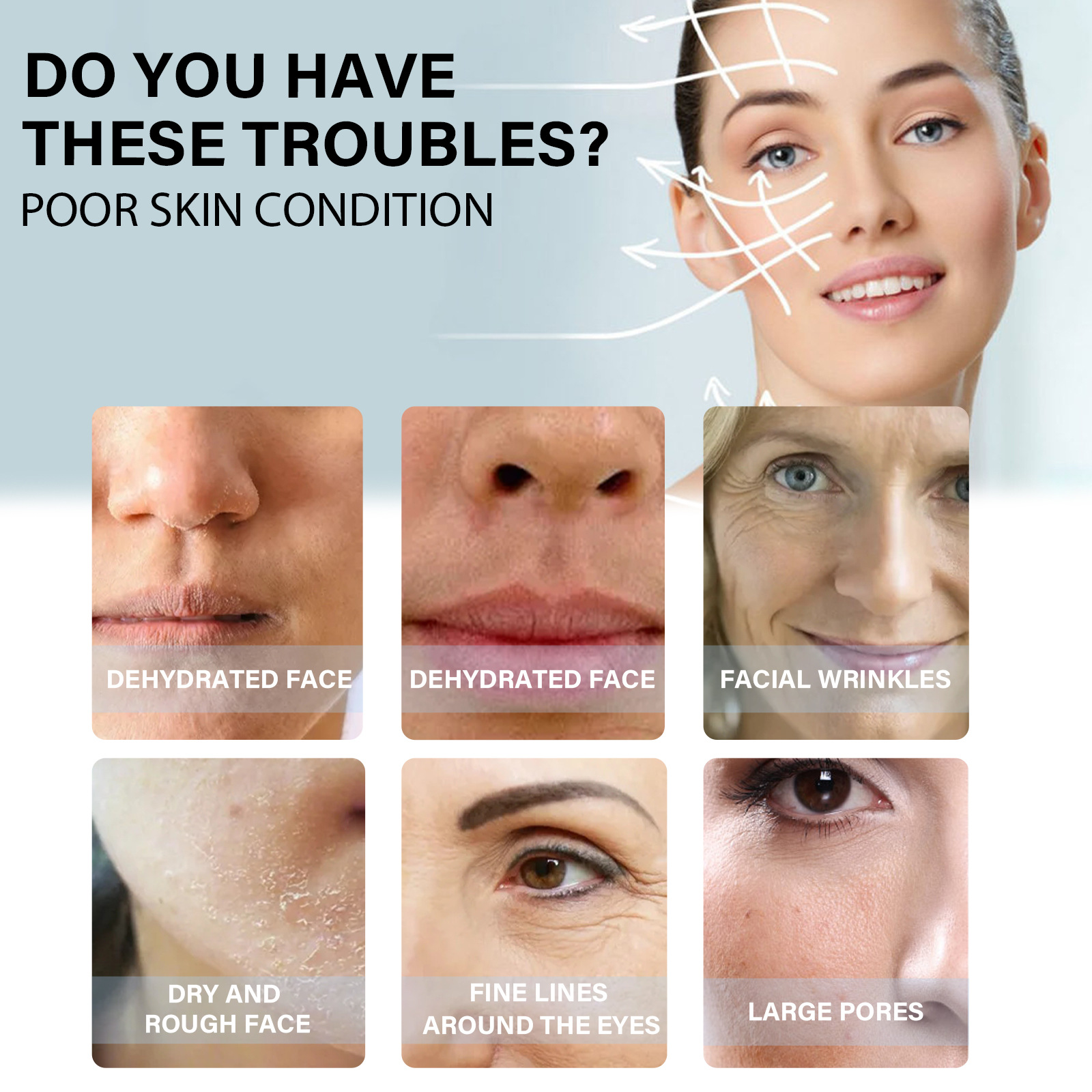 Linha de lifting de proteína EELHOE antirrugas para pele em V, lifting facial, firmeza, relaxamento dos contornos faciais, redução de medidas finas_voghion.com