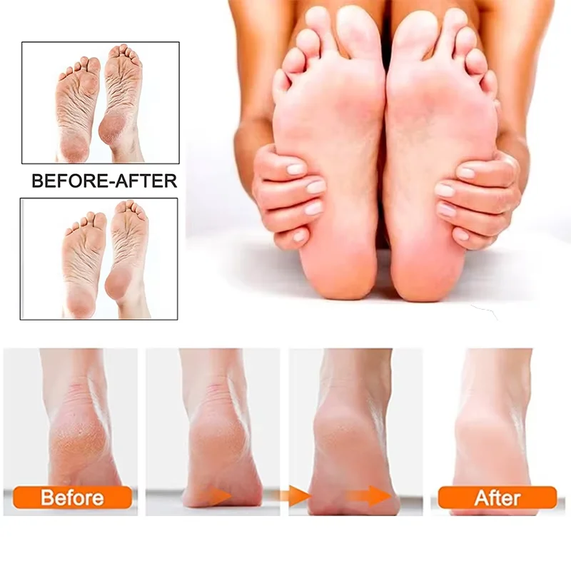 Professional Electric Foot Callus Remover Rechargeable Pedicure Kit_voghion.com