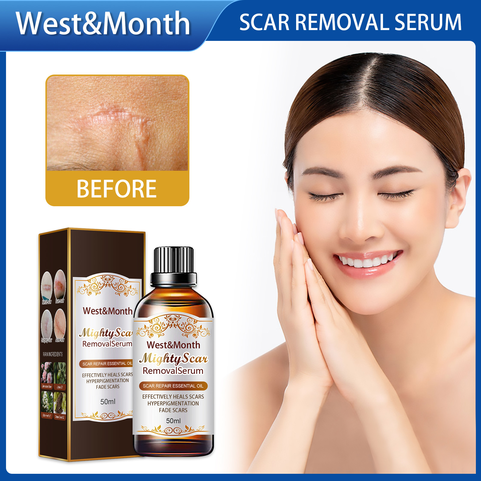 Crème dissolvante West Month pour les vieilles cicatrices, réparation des cicatrices, élimination efficace des cicatrices, huile essentielle pour le visage, anti-acné