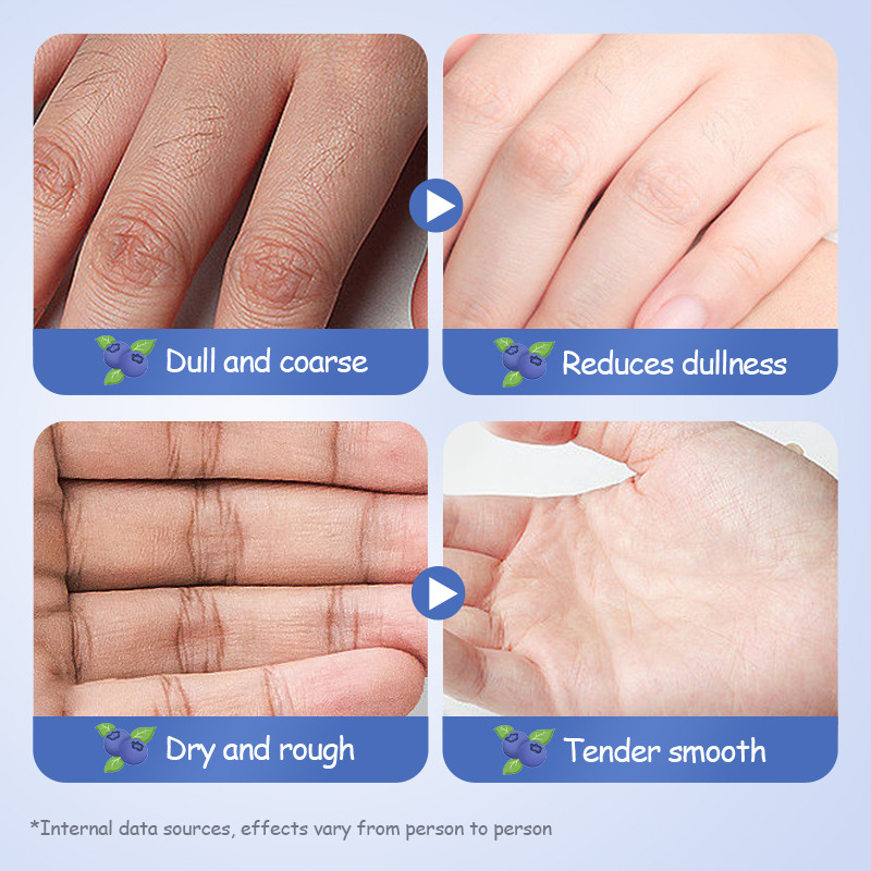 SADOER Crème pour les mains hydratante anti-fissures sèches à la myrtille pour l'automne et l'hiver_voghion.com