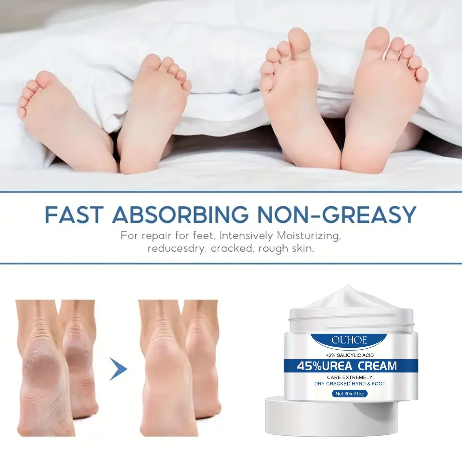 Anti Secchezza Crema Per I Piedi Urea Crepa Tallone Calli Rimozione Della Pelle Morta Lenitiva Screpolature Riparazione Idratante Idratazione Mano Piedi Cura_voghion.com