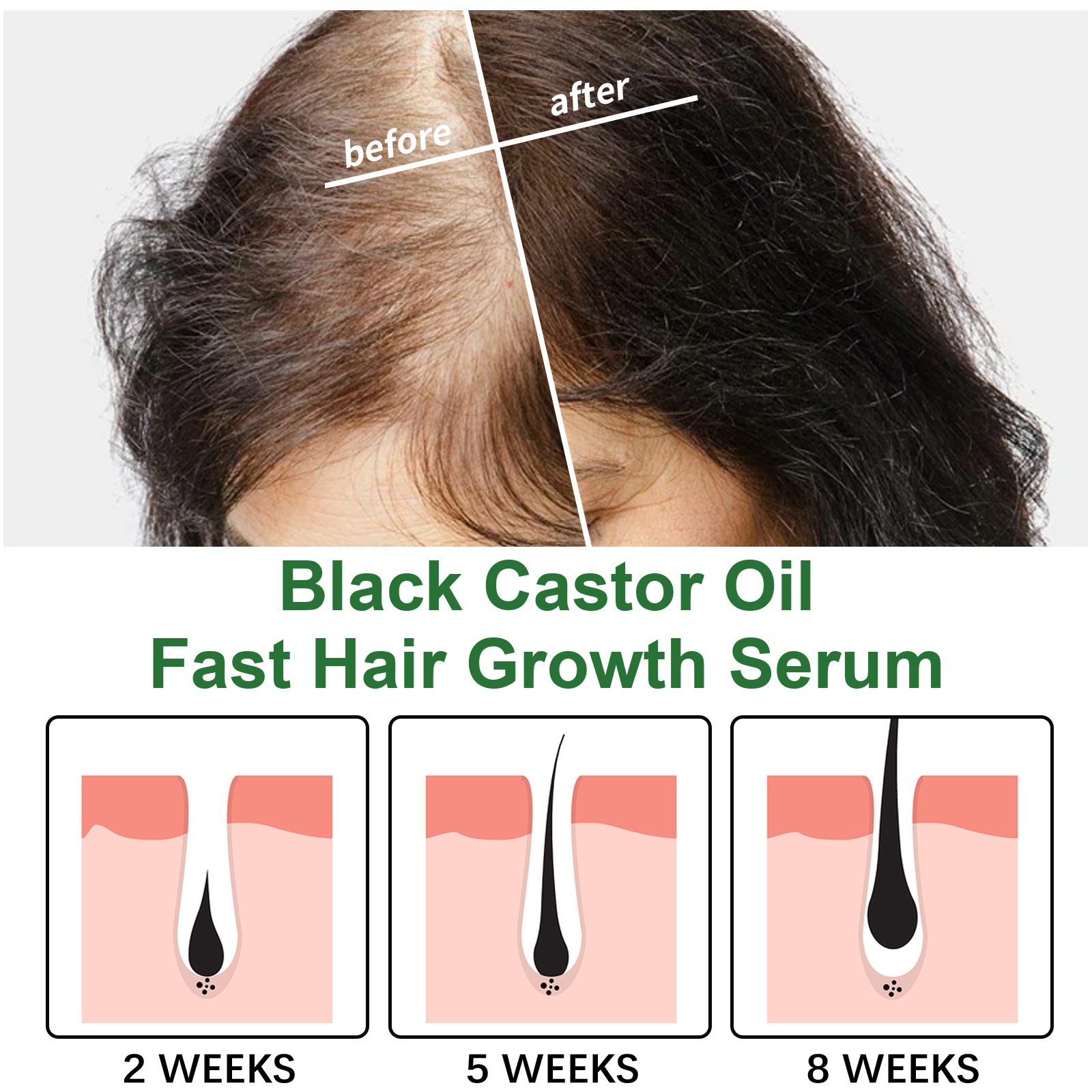 Jayswing Castor Oil Dense Essence Pflegender, robuster, fester und dicker Conditioner zur Vorbeugung von Haarausfall_voghion.com