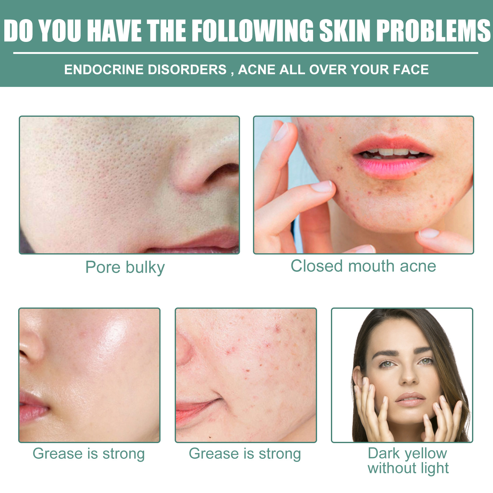 L'essenza del retinolo Jaysuing può resistere alle rughe sul viso, migliorare le linee sottili, illuminare, rassodare, elasticizzare, tenero e restringere_voghion.com