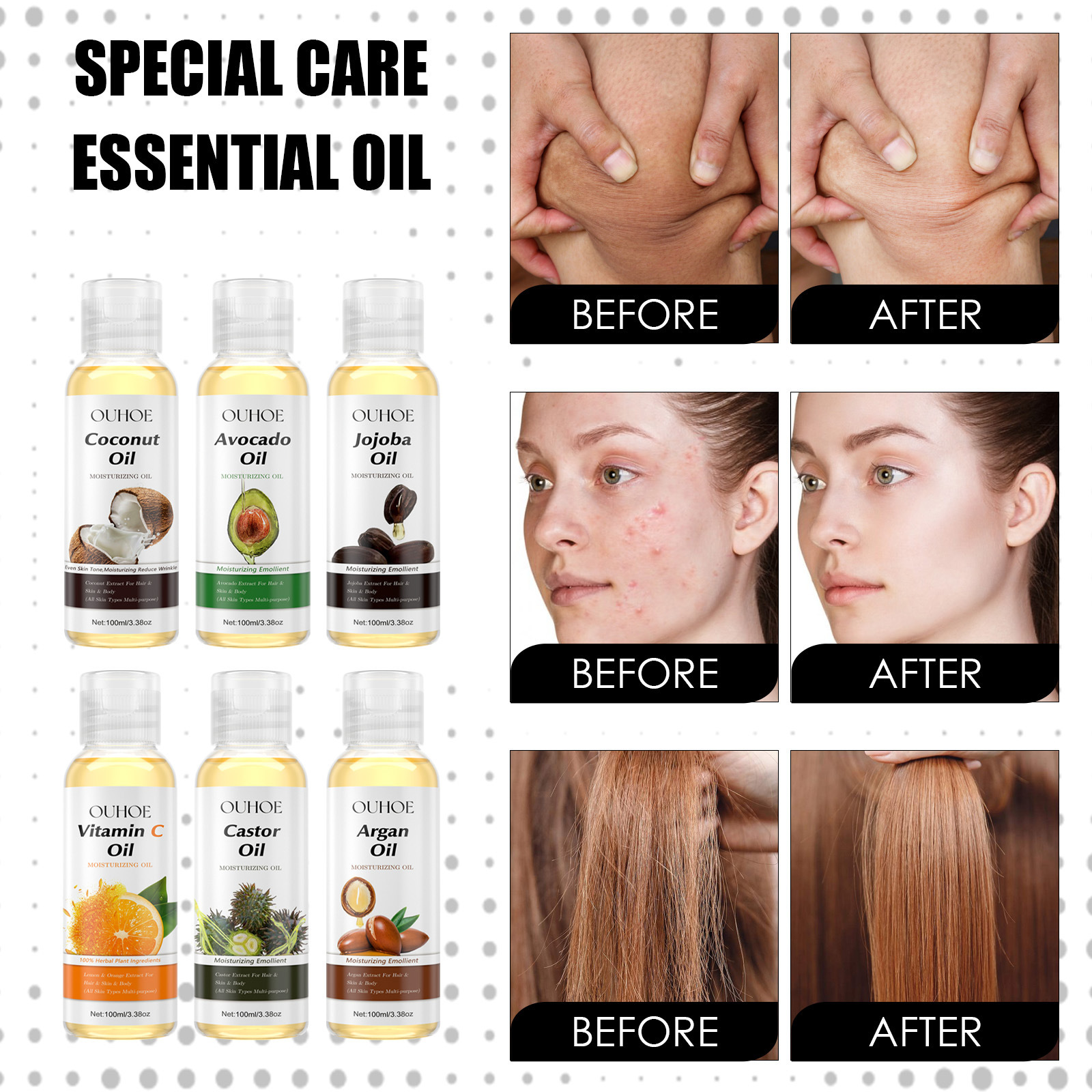 OUHOE Olio Essenziale Riparatore Sei in Uno Idrata profondamente il viso, rassoda, schiarisce le linee sottili, illumina la pelle e_voghion.com