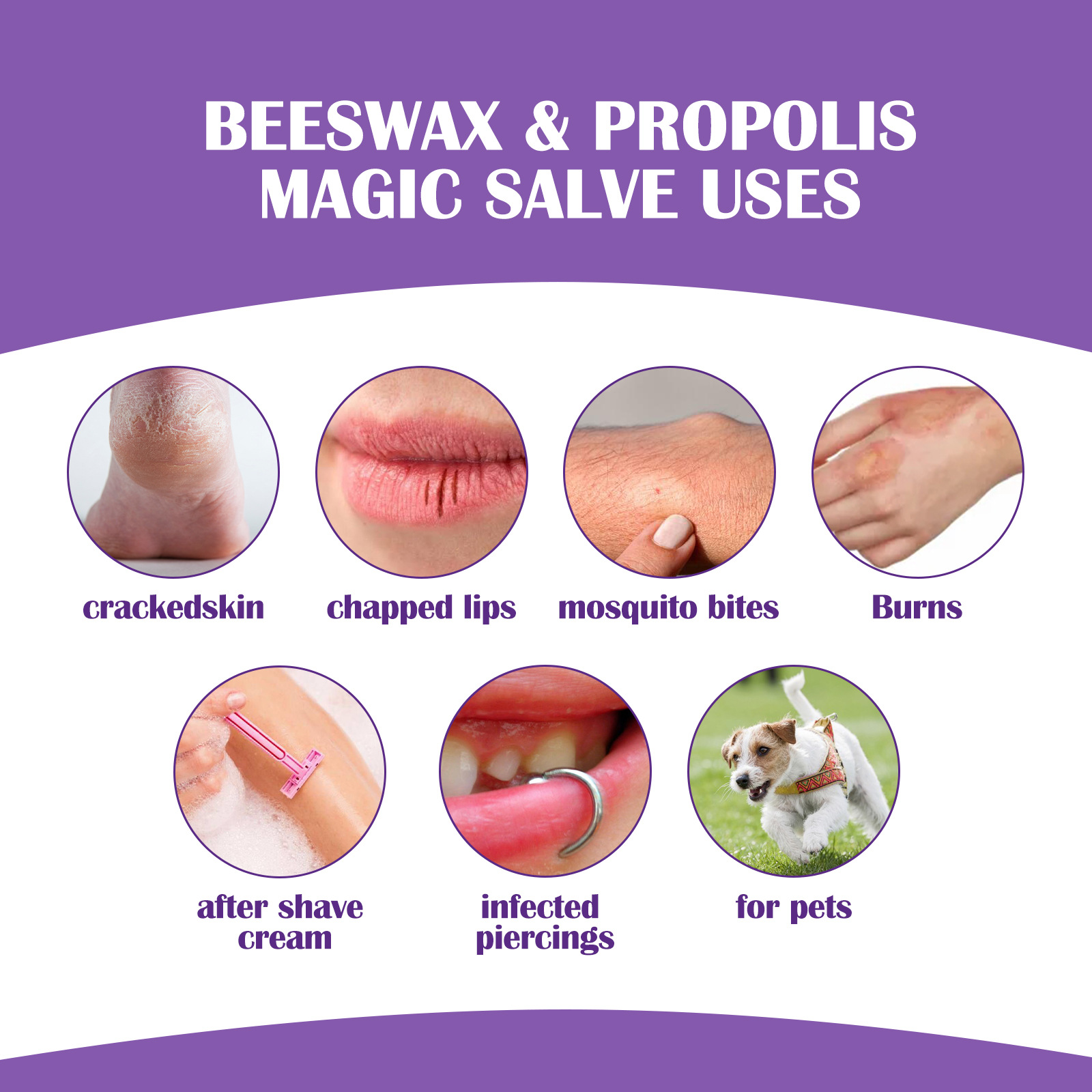 EELHOE Propolis-Reparaturcreme zur Linderung subkutaner Knoten, spendet der Haut Feuchtigkeit, repariert sanft und reinigt die Haarfollikel_voghion.com