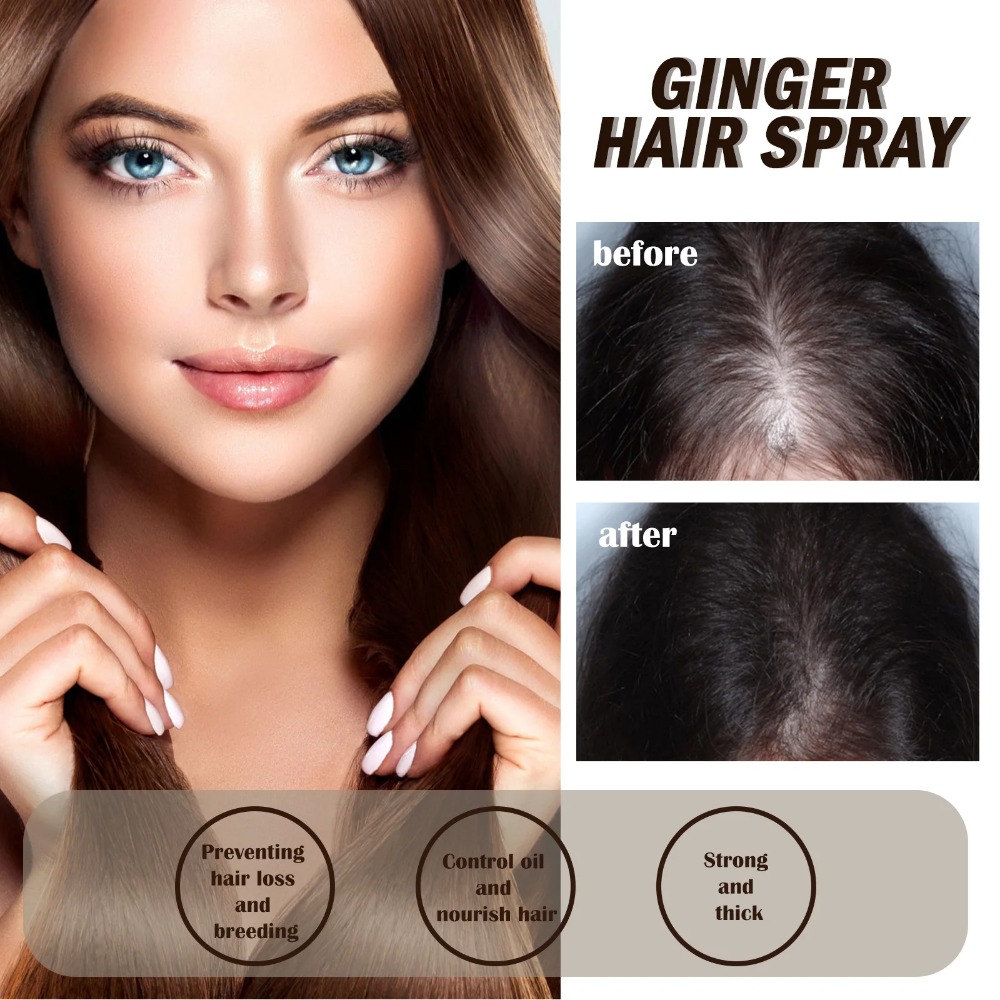 Leistungsstarkes Haarwuchs-Serum-Spray mit Ingwer, Anti-Haarausfall-Behandlungsprodukte, Reparatur, Pflege der Haarwurzeln, schnelles Nachwachsen der Haare bei Männern und Frauen_voghion.com