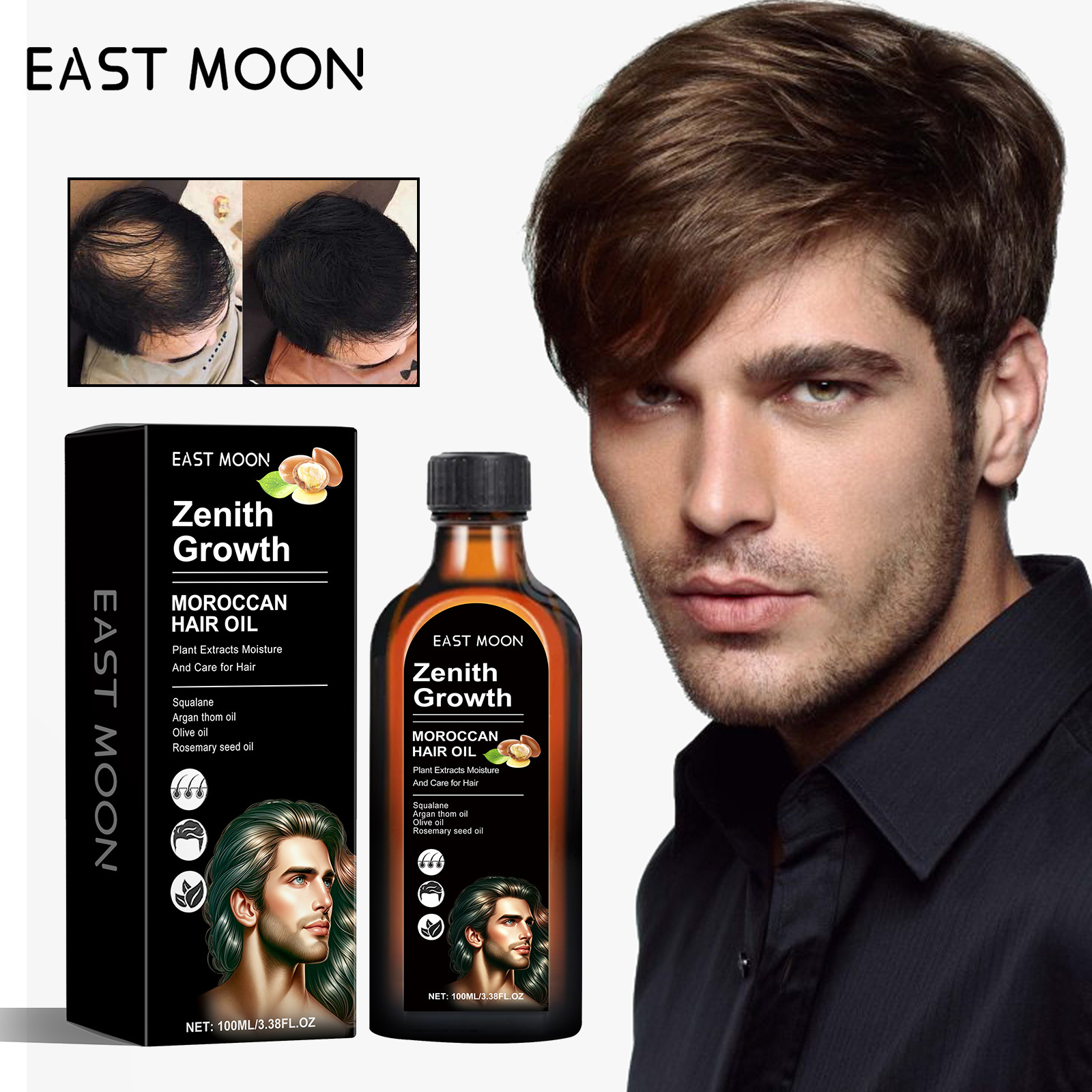 East Moon Rosemary Care Essential Reparéiert dréchen Hoer, pflegt d'Hoerwurzelen, stäerkt déckt an straffend Hoer Essenzöl_voghion.com