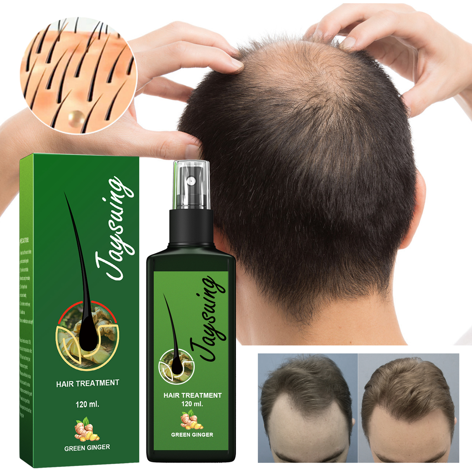 Jaysuing Scalp & Hair Care Spray - Gentle Nourishment For Daily Massage, Hydrates For Silky Smooth Hair_voghion.com