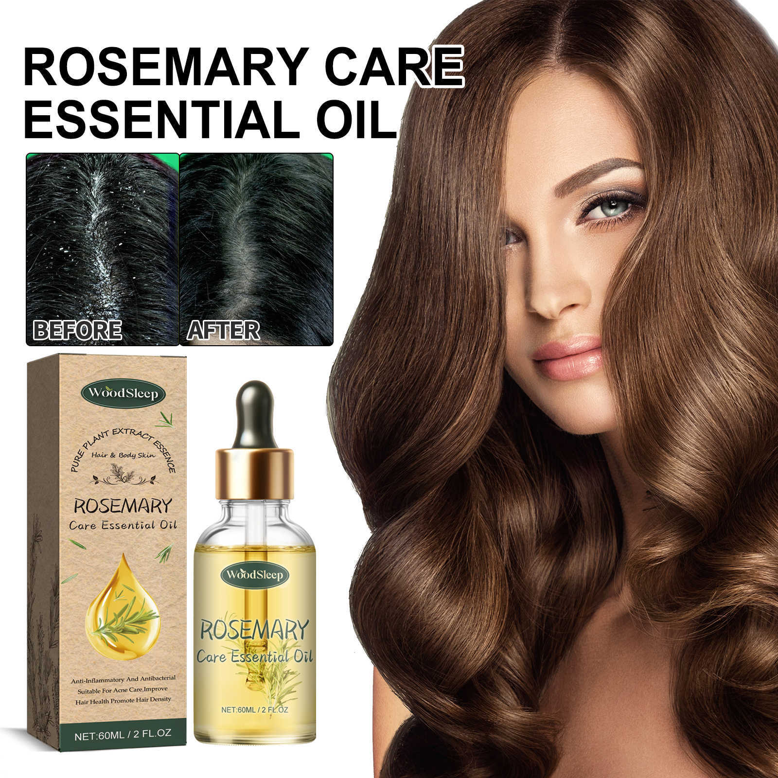 WoodSleep rozmaring masszázs esszenciális arcápoló pattanásjavító, hidratáló, hidratáló és simító bőrápoló olaj_voghion.com