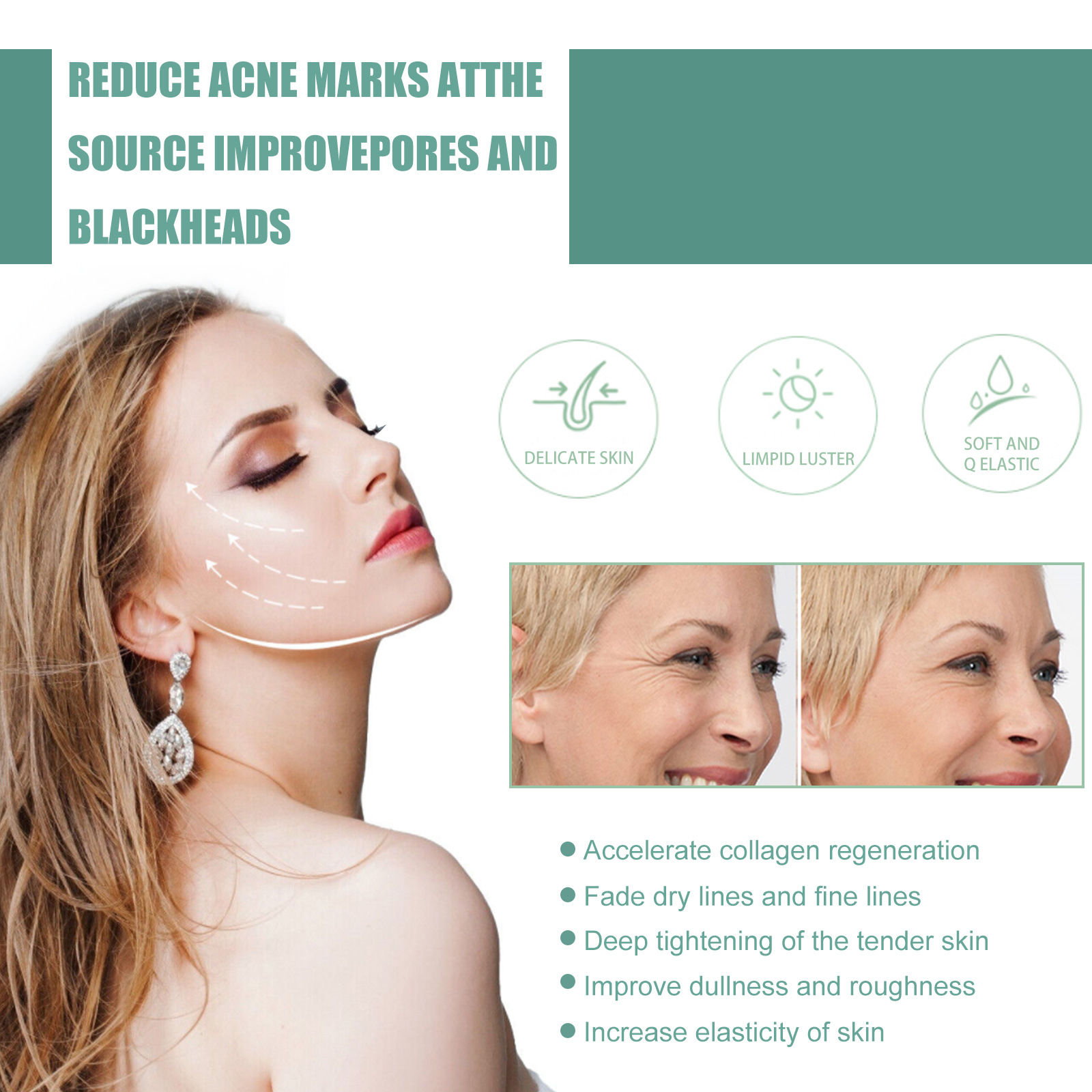 L'essenza del retinolo Jaysuing può resistere alle rughe sul viso, migliorare le linee sottili, illuminare, rassodare, elasticizzare, tenero e restringere_voghion.com