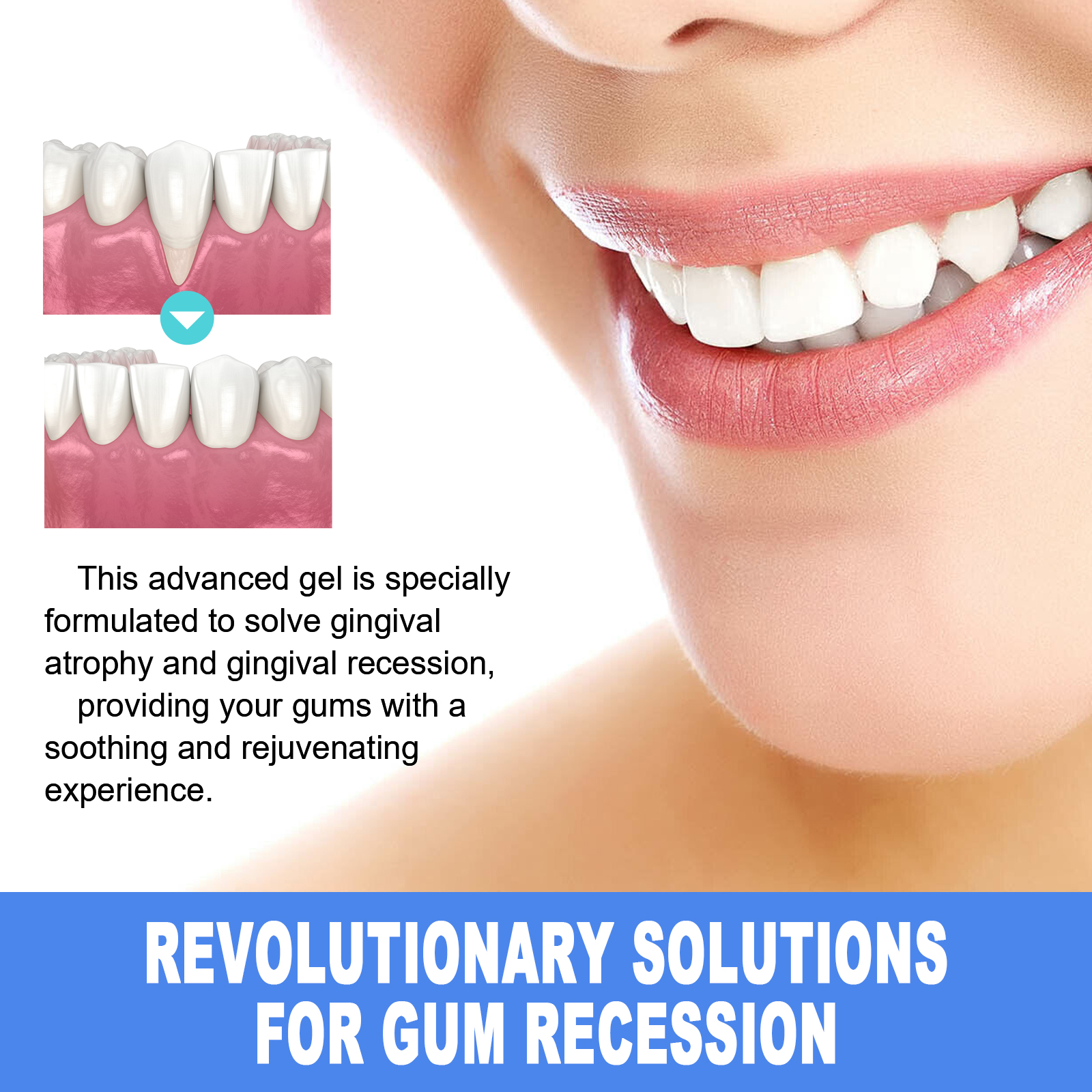 EELHOE Mild Cleaning Yellow Tooth Stain Fresh Care Gel_voghion.com