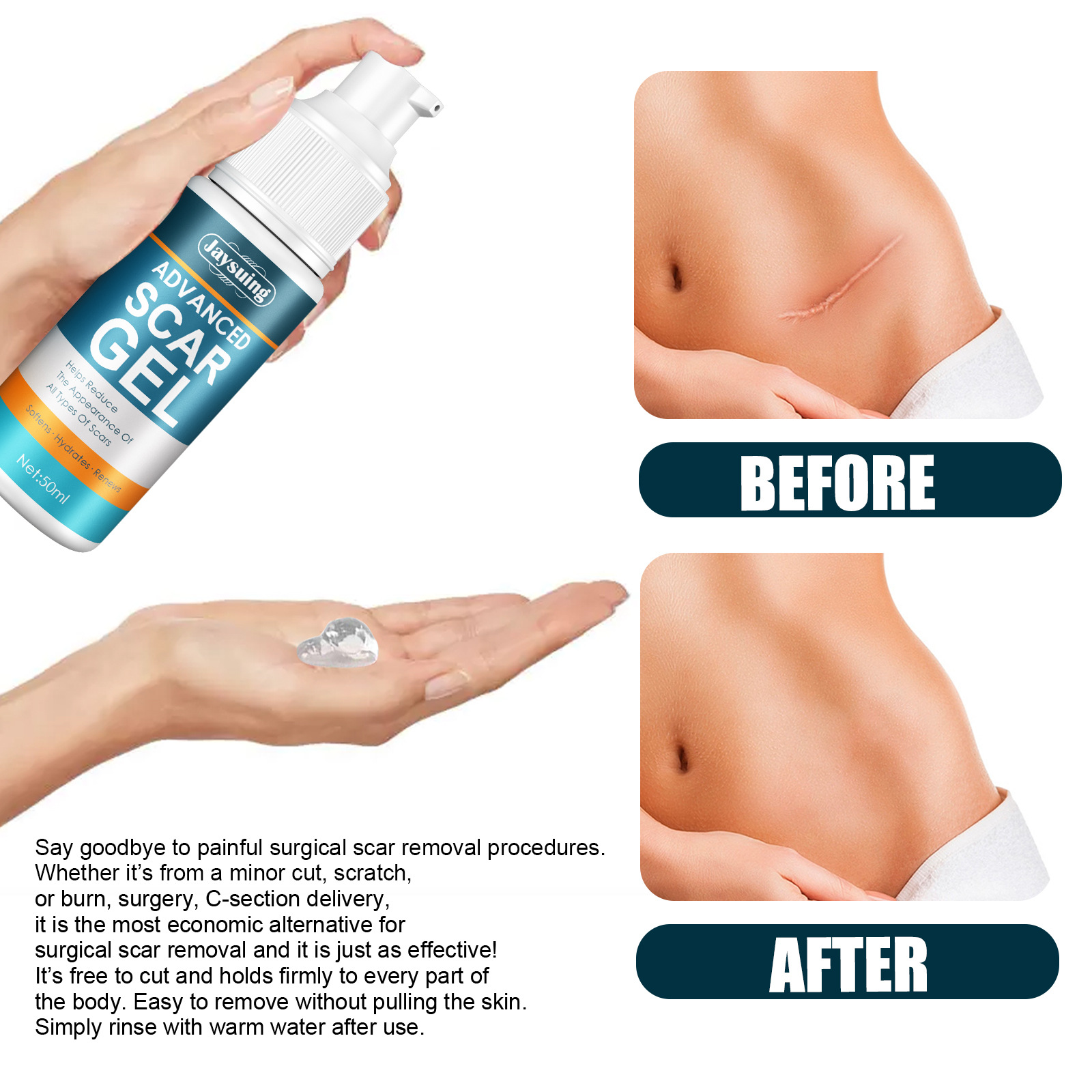 Jayswing Lightening gel Reparationscreme Postpartum Graviditetsaroperation udglatter huden_voghion.com