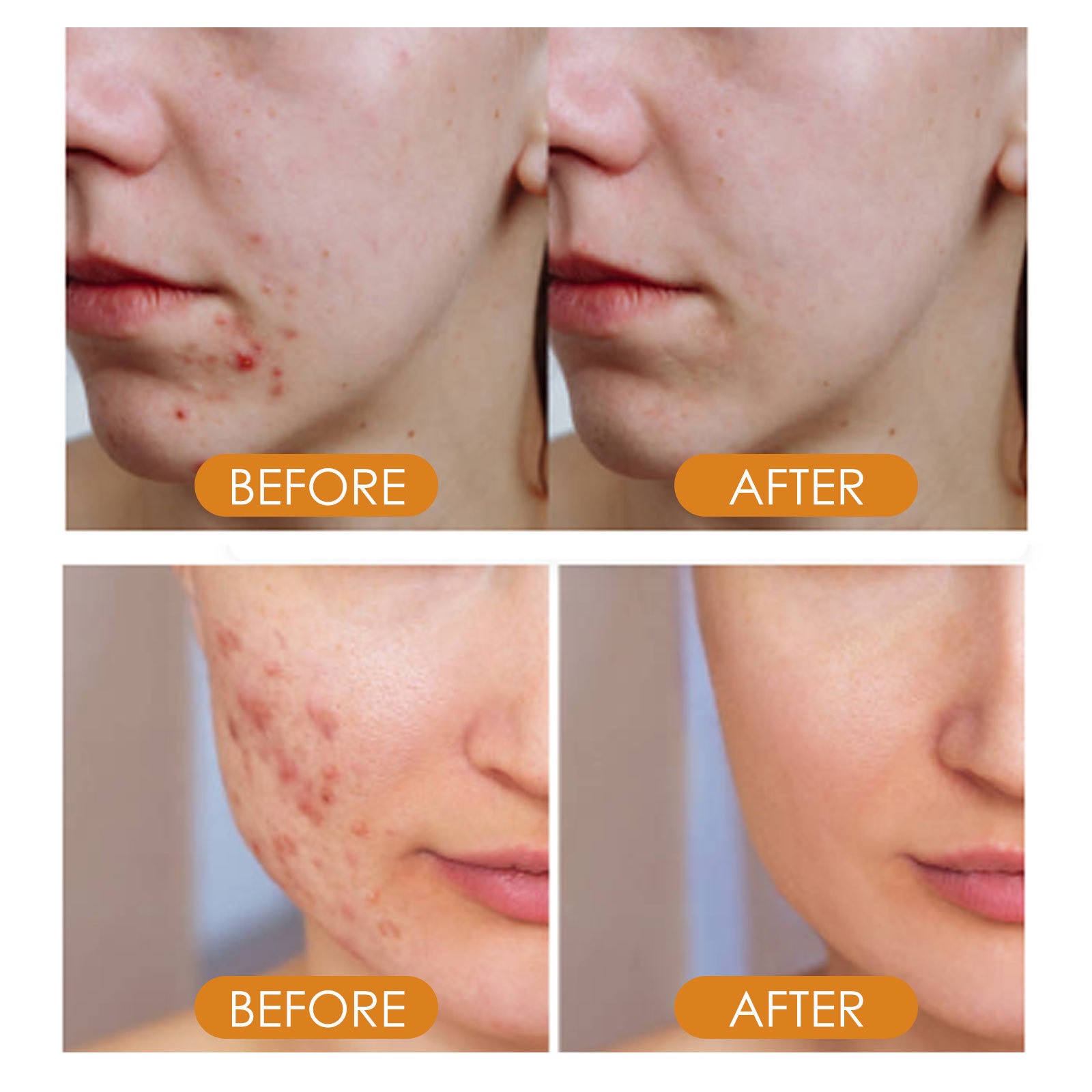 Hoygi Vitamin C kann feine Linien und Fältchen reduzieren, die Gesichtshaut mit Feuchtigkeit versorgen und die Essenz straffen_voghion.com