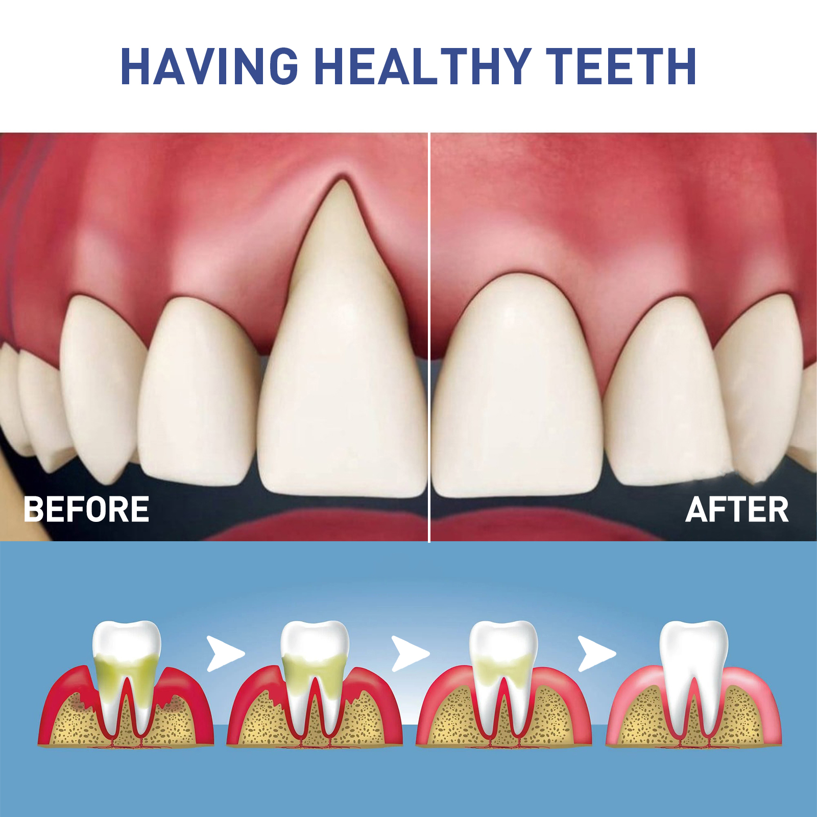 WestMonth Gentle Gum Care Gel - Soothes Irritated Gums, Reduces Plaque & Brightens Teeth, Daily Oral Hygiene Formula, EU Compliant & CPNP Notified_voghion.com