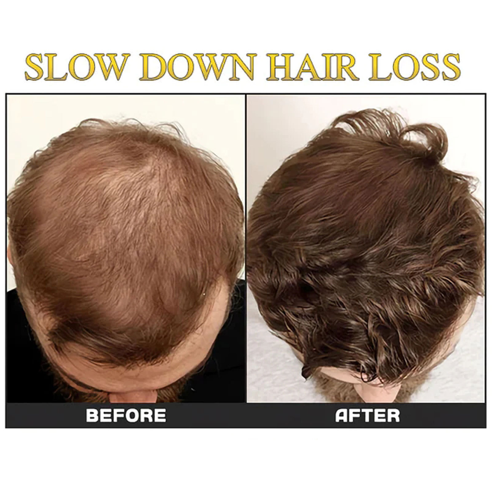 Essenza EELHOE Hair Dense Ball_voghion.com