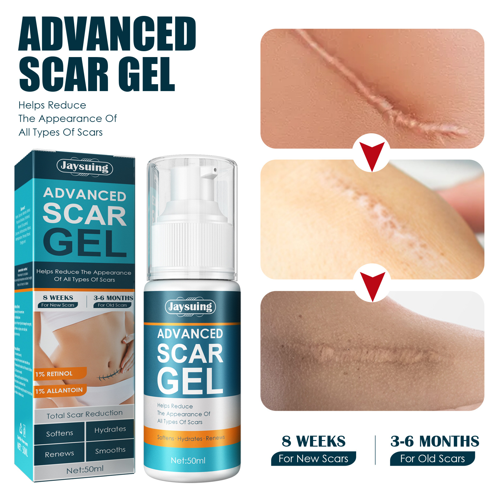Jayswing Lightening gel Reparationscreme Postpartum Graviditetsaroperation udglatter huden_voghion.com