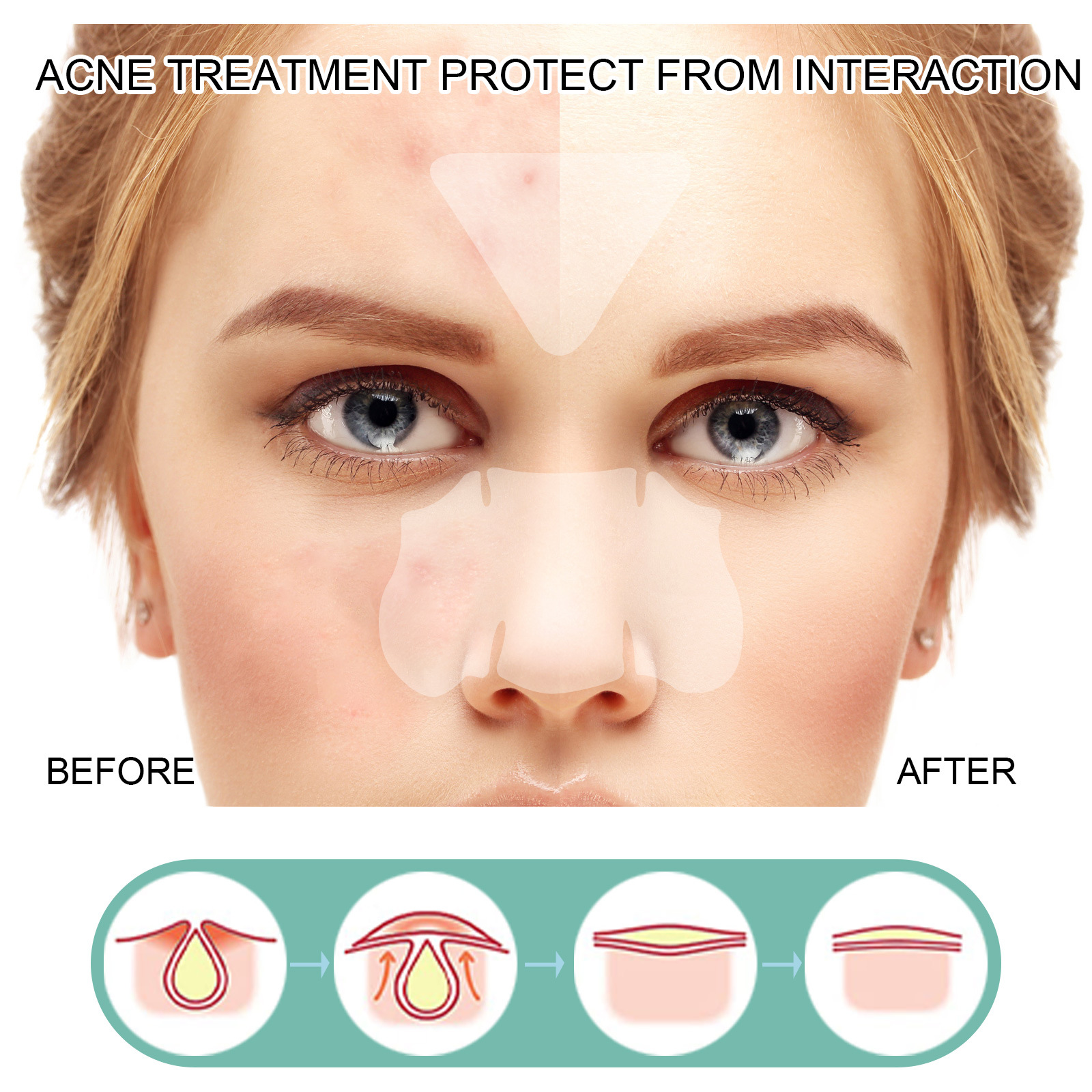 Maschera facciale EELHOE Schiarisci la stampa Patch delicata e non irritante per la rimozione della pulizia dell'acne_voghion.com