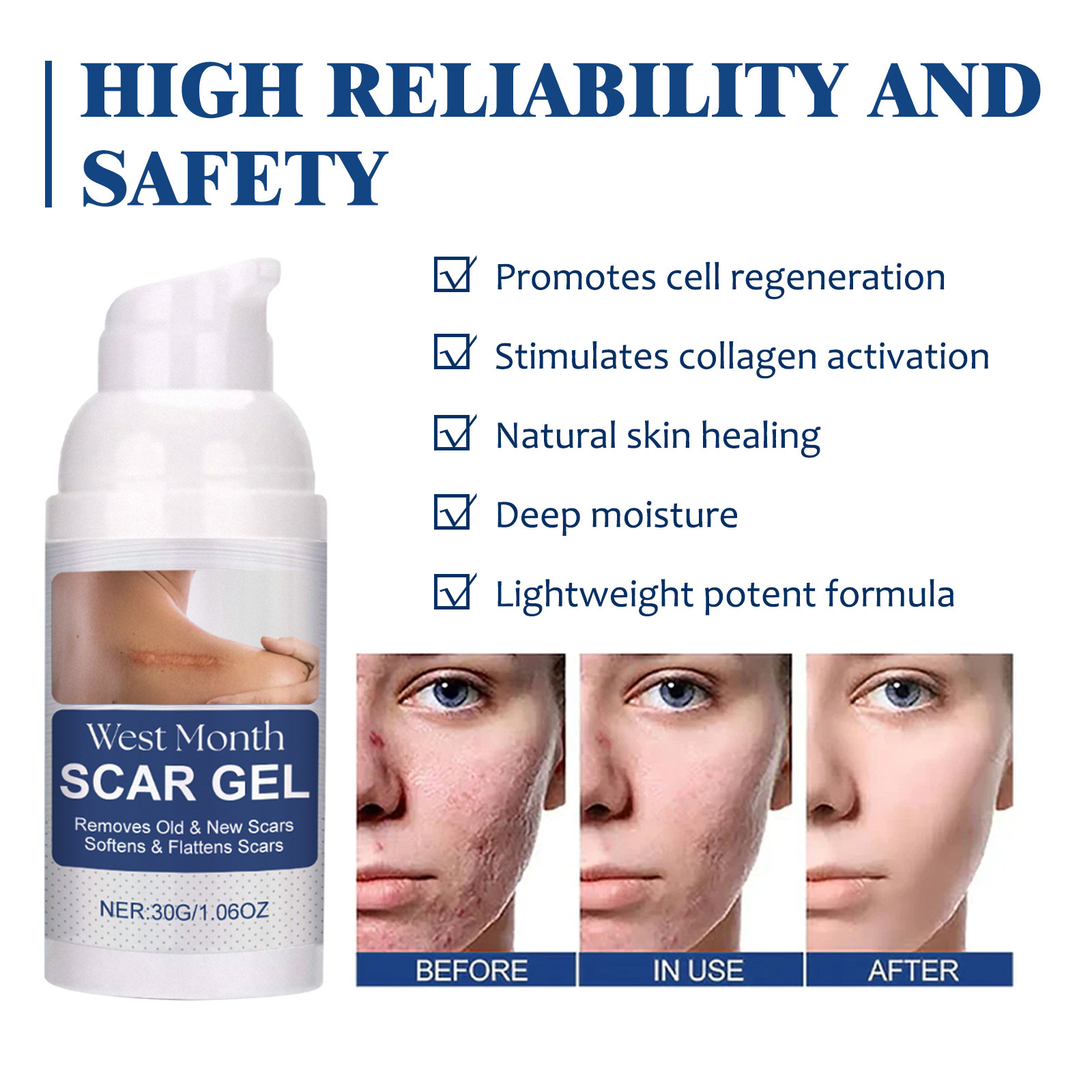 West&Month Lightening repariert geschädigte Haut, hellt Narbennarben auf und glättet das Hautpflegegel_voghion.com