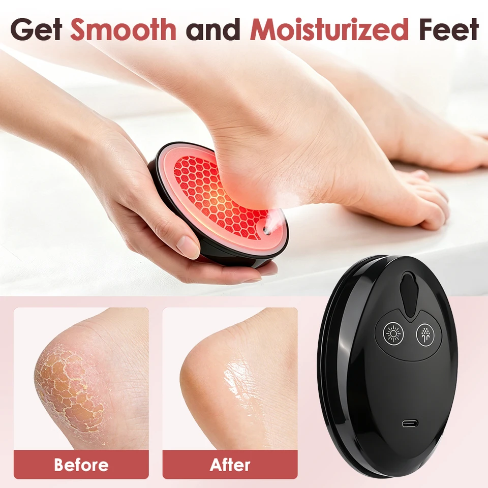 Râpe pieds électrique avec spray hydratant pour peaux mortes_voghion.com