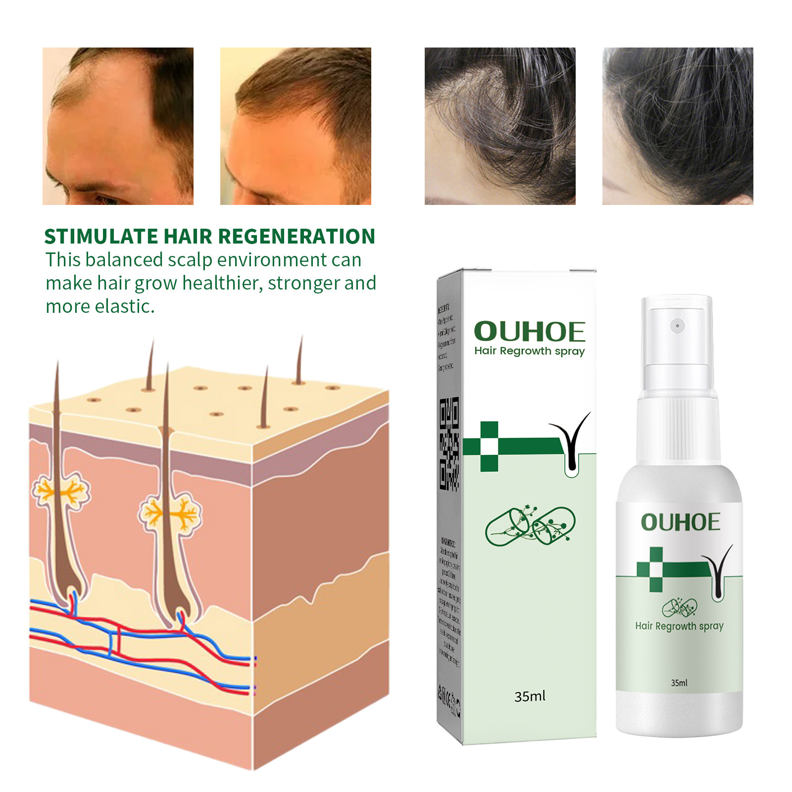 OUHOE Growth Repairs Follikelskada Torrt hårigt hår Tjockt spray mot håravfall_voghion.com