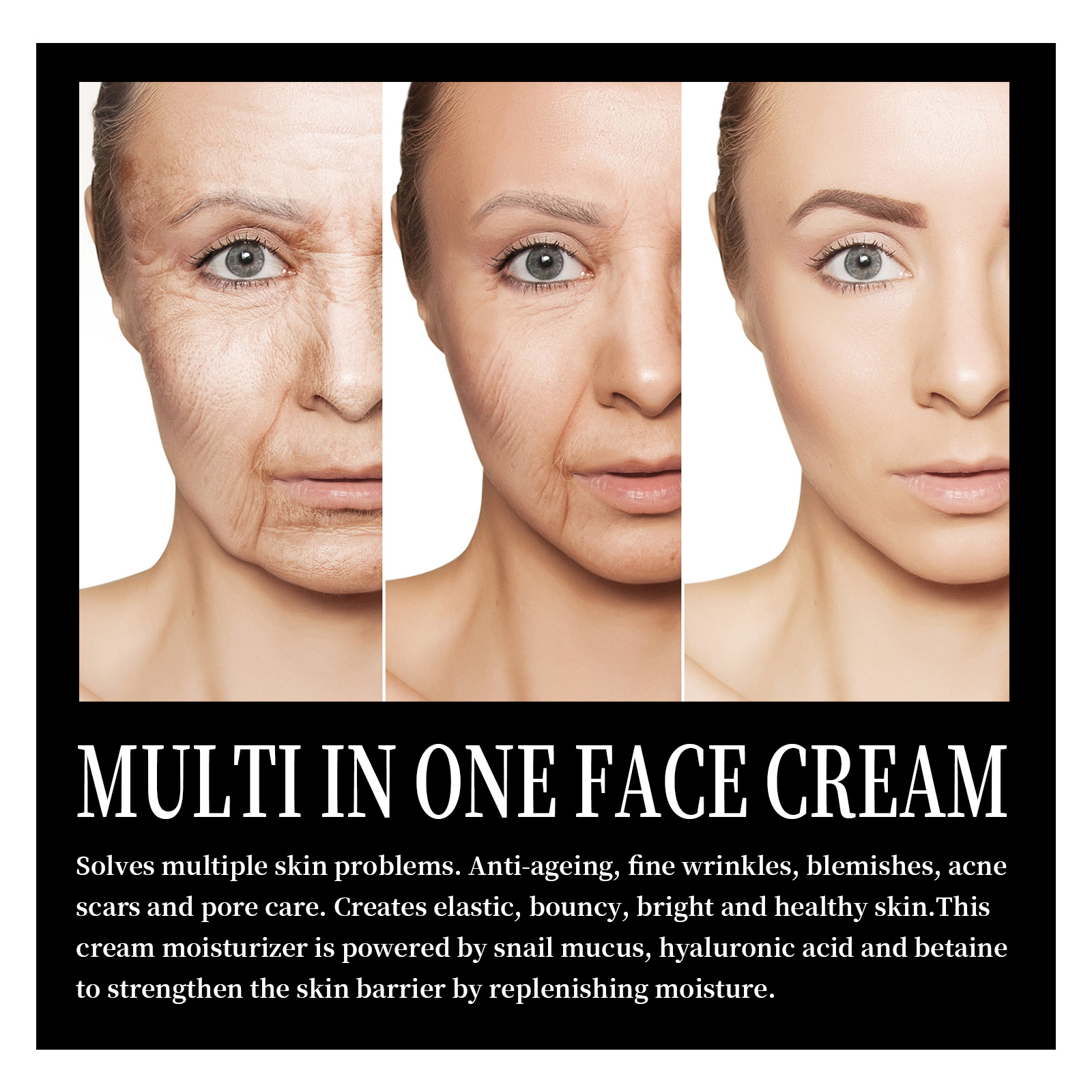La crème pour le visage à l'escargot OUHOE éclaircit les ridules, hydrate et raffermit la peau, essence anti-âge_voghion.com