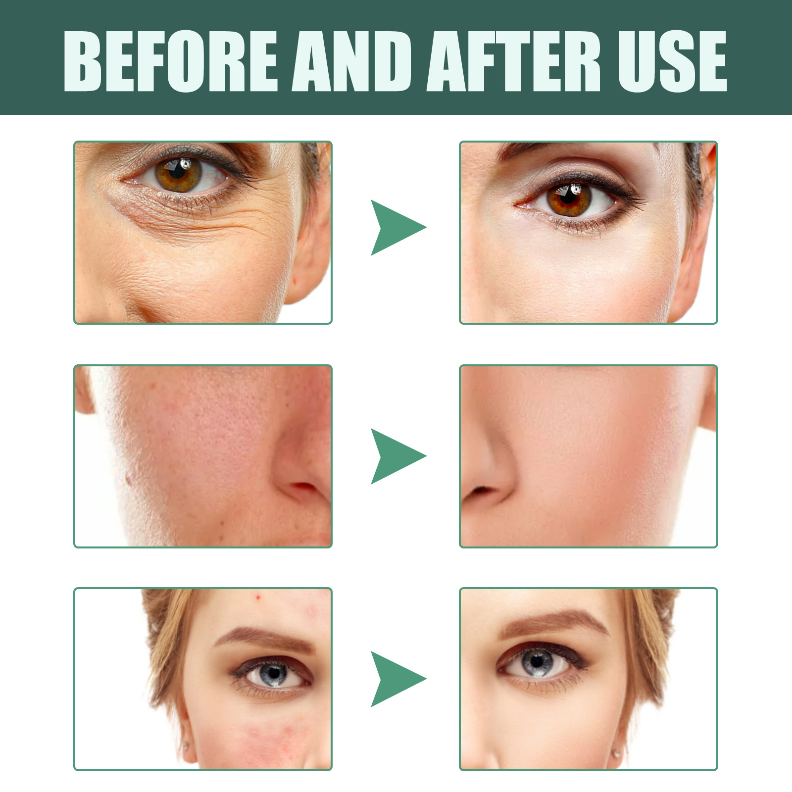 L'essenza del retinolo Jaysuing può resistere alle rughe sul viso, migliorare le linee sottili, illuminare, rassodare, elasticizzare, tenero e restringere_voghion.com