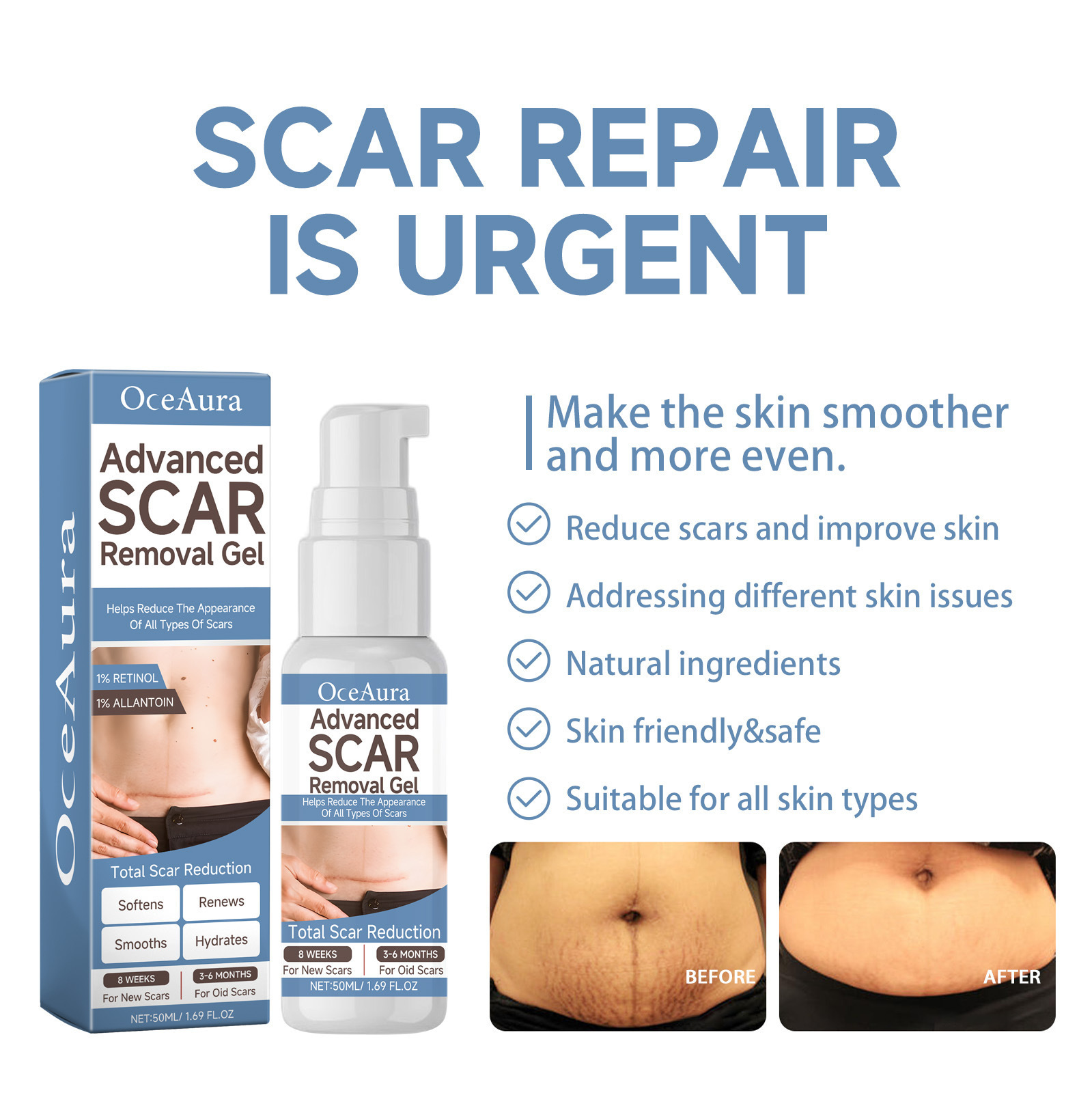Gel de desalinizare OCEAURA, hidratat și netezit, pentru repararea cicatricilor chirurgicale ale pielii, pentru îngrijirea sarcinii._voghion.com
