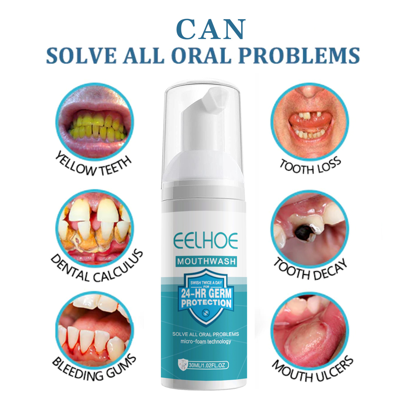 Mousse detergente per denti Pressa per pulire i denti, Smok.e Macchie dentali, Anti carie, Alito fresco 2024 più popolare_voghion.com