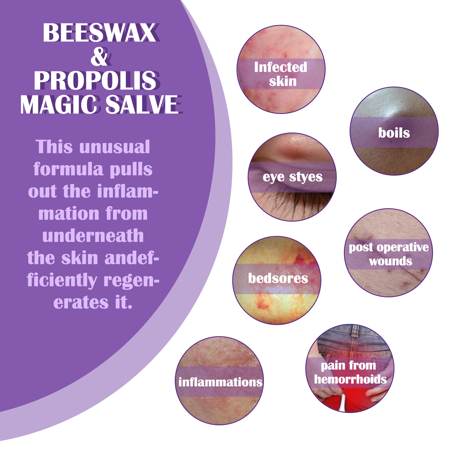 EELHOE Propolis-Reparaturcreme zur Linderung subkutaner Knoten, spendet der Haut Feuchtigkeit, repariert sanft und reinigt die Haarfollikel_voghion.com