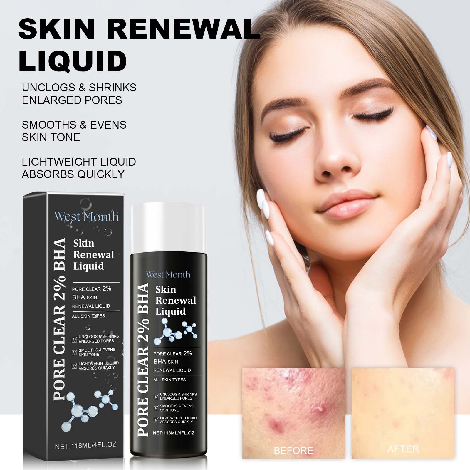 West&Month Salicylic Acid Acne Removing to fade marks, repair skin, mildly remove acne and moisturize essence_voghion.com