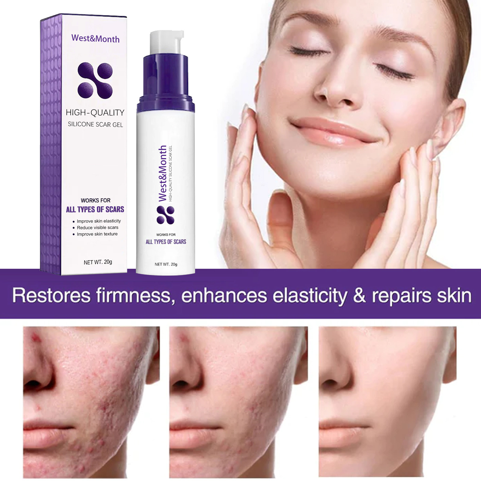 West&Month for at lette acnemærker, arreparation ved graviditetskirurgi hududglattende creme_voghion.com