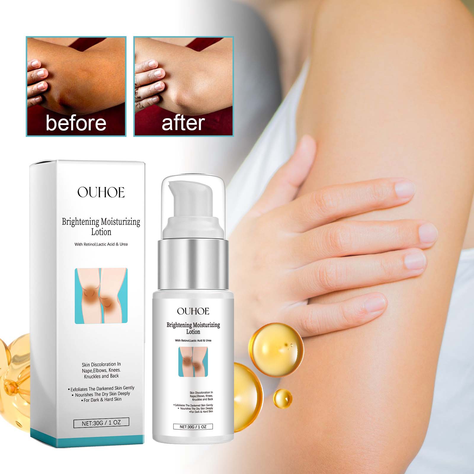 Ouhoe Whitening Milk For Body Underarm Knee And Joint Brightening_voghion.com