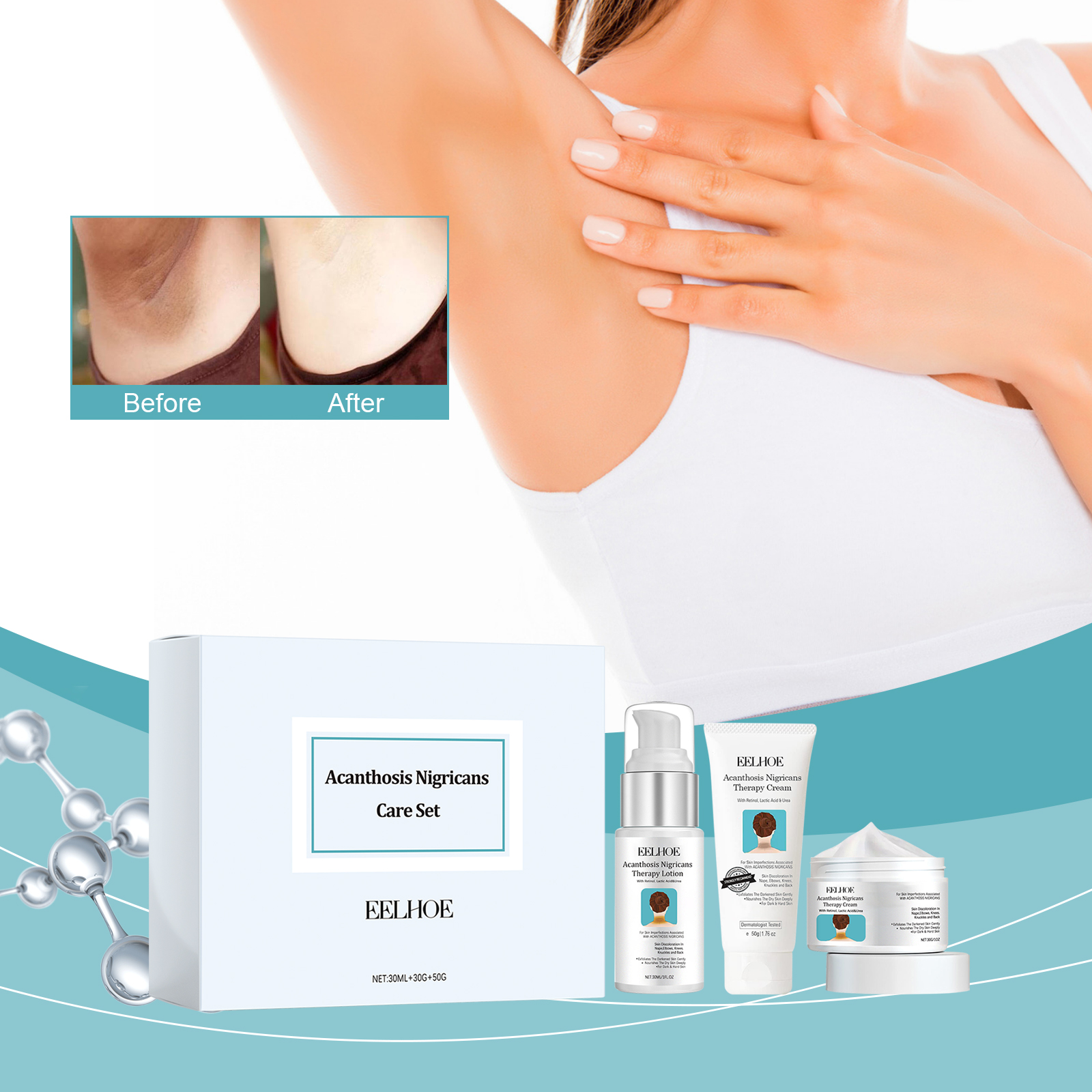 EELHOE Black Acanthosis Skin Repair Set For Repairing Blackened Armpits, Arms, Knees And Joints, Moisturizing And Whitening Body Care Cream_voghion.com