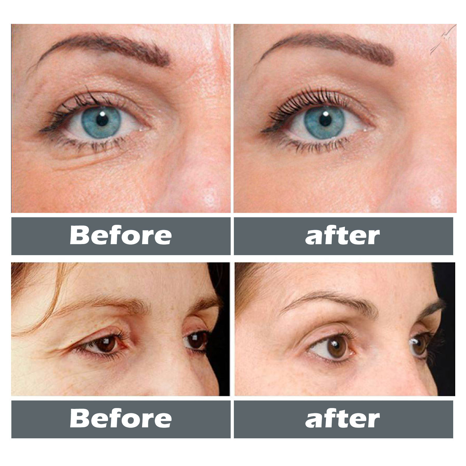 OUHOE Collagen aging schiarisce ripara le linee sottili e le macchie nere intorno agli occhi, idrata ed è un'essenza antirughe_voghion.com