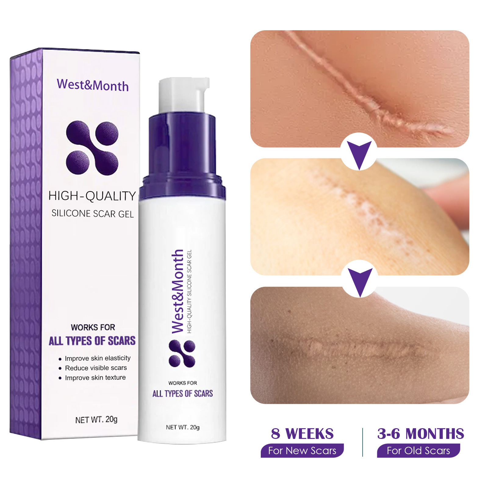 West&Month for at lette acnemærker, arreparation ved graviditetskirurgi hududglattende creme_voghion.com