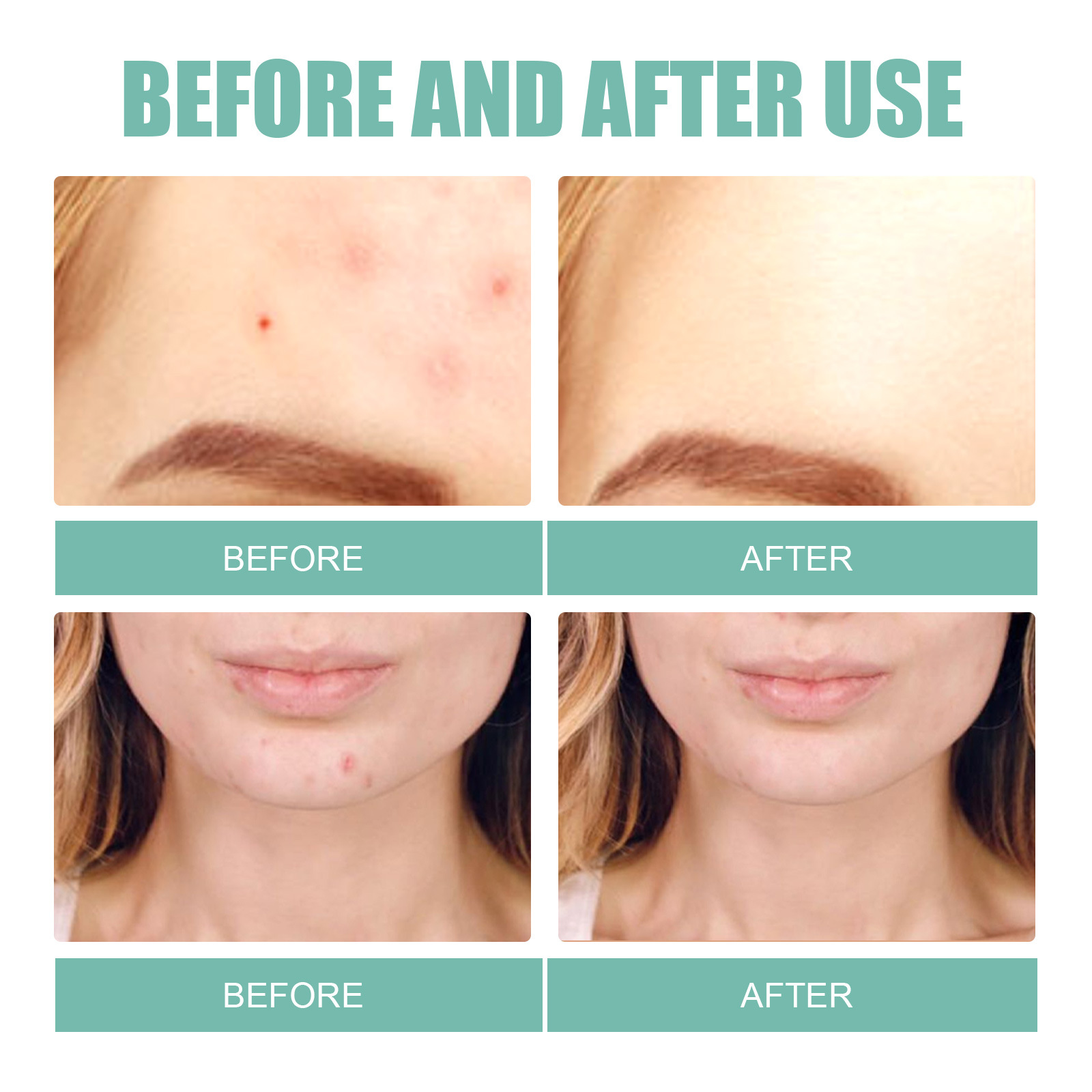 Maschera facciale EELHOE Schiarisci la stampa Patch delicata e non irritante per la rimozione della pulizia dell'acne_voghion.com