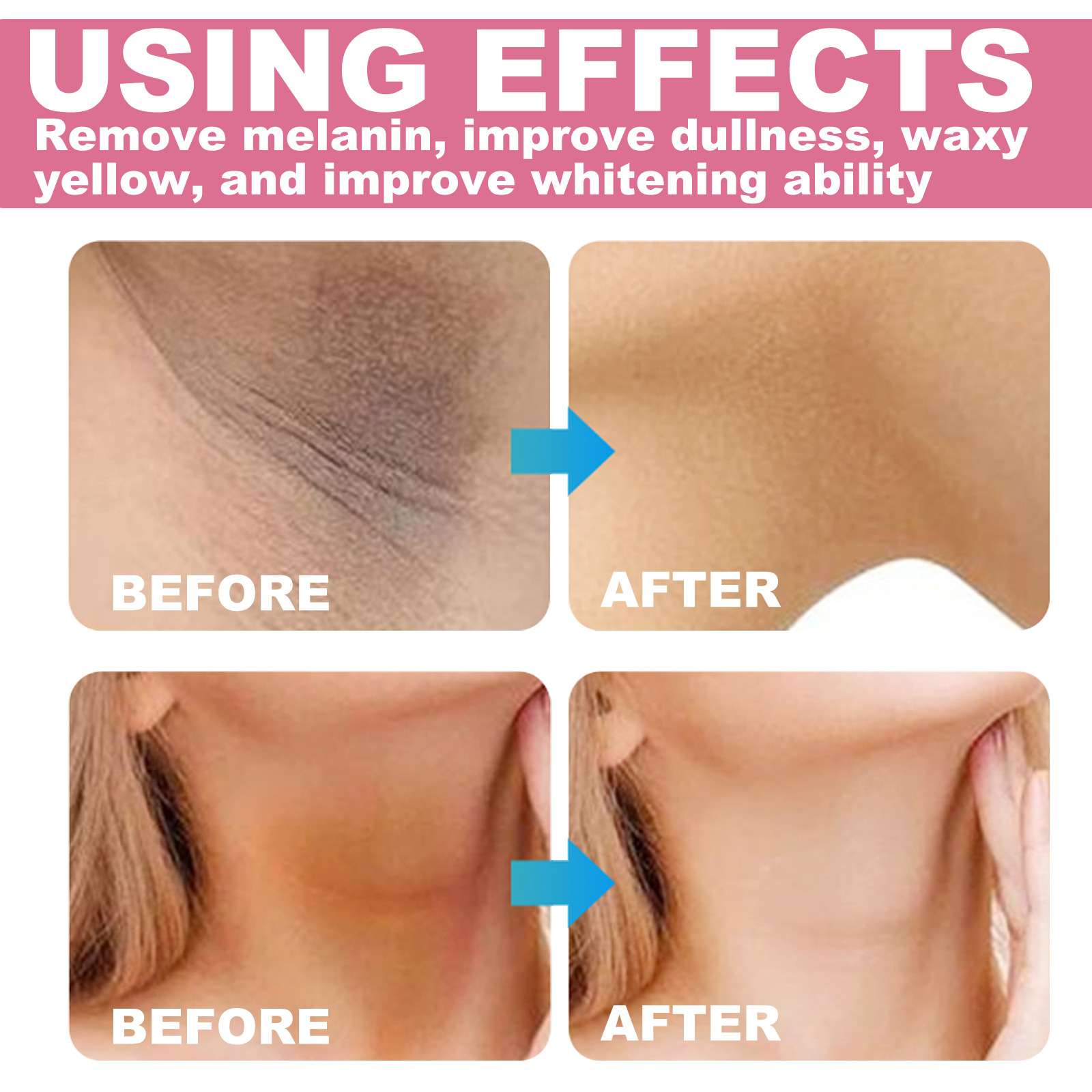 EELHOE Whitening&Brightening Reduces Melanin concealer in Underarm Privacy Moisturizing Skin Care Cream_voghion.com