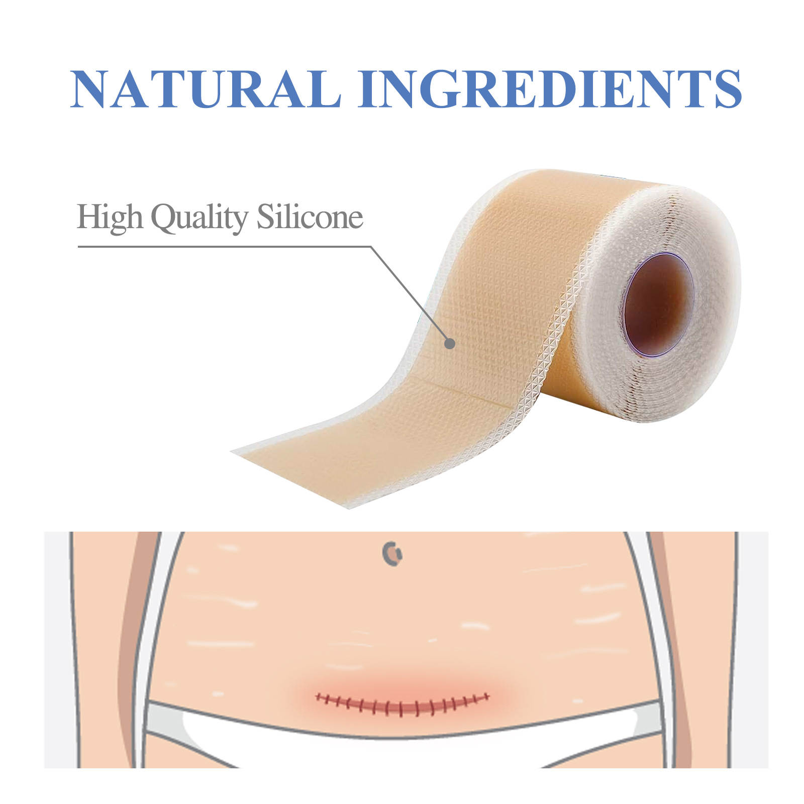 South Moon – patch de beauté en silicone pour éclaircir les cicatrices chirurgicales de grossesse, patch de beauté pour cicatrices cutanées imperméables et respirantes_voghion.com