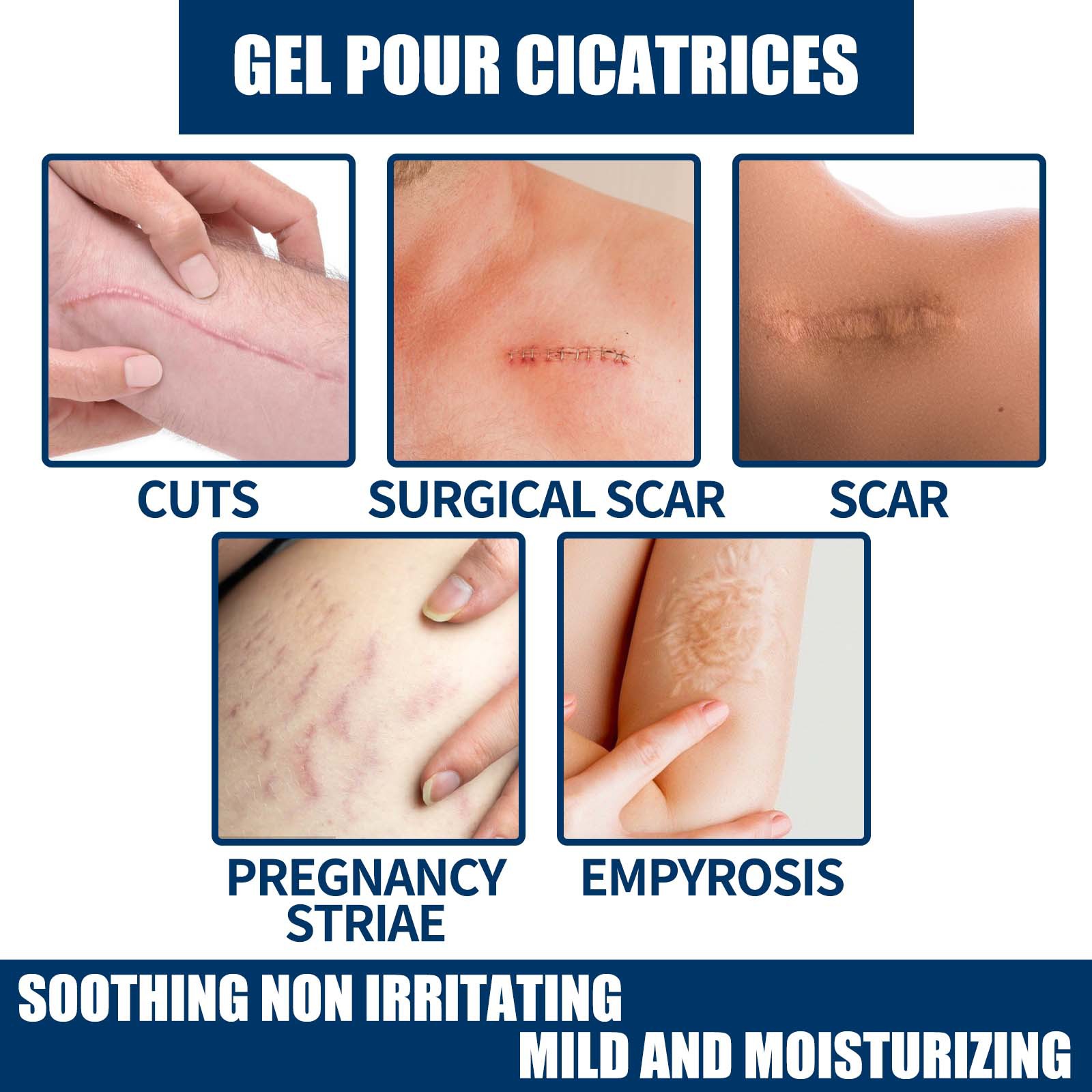 EELHOE scar gel external cold compress cream skin damage repair type softening, smoothing and moisturizing_voghion.com