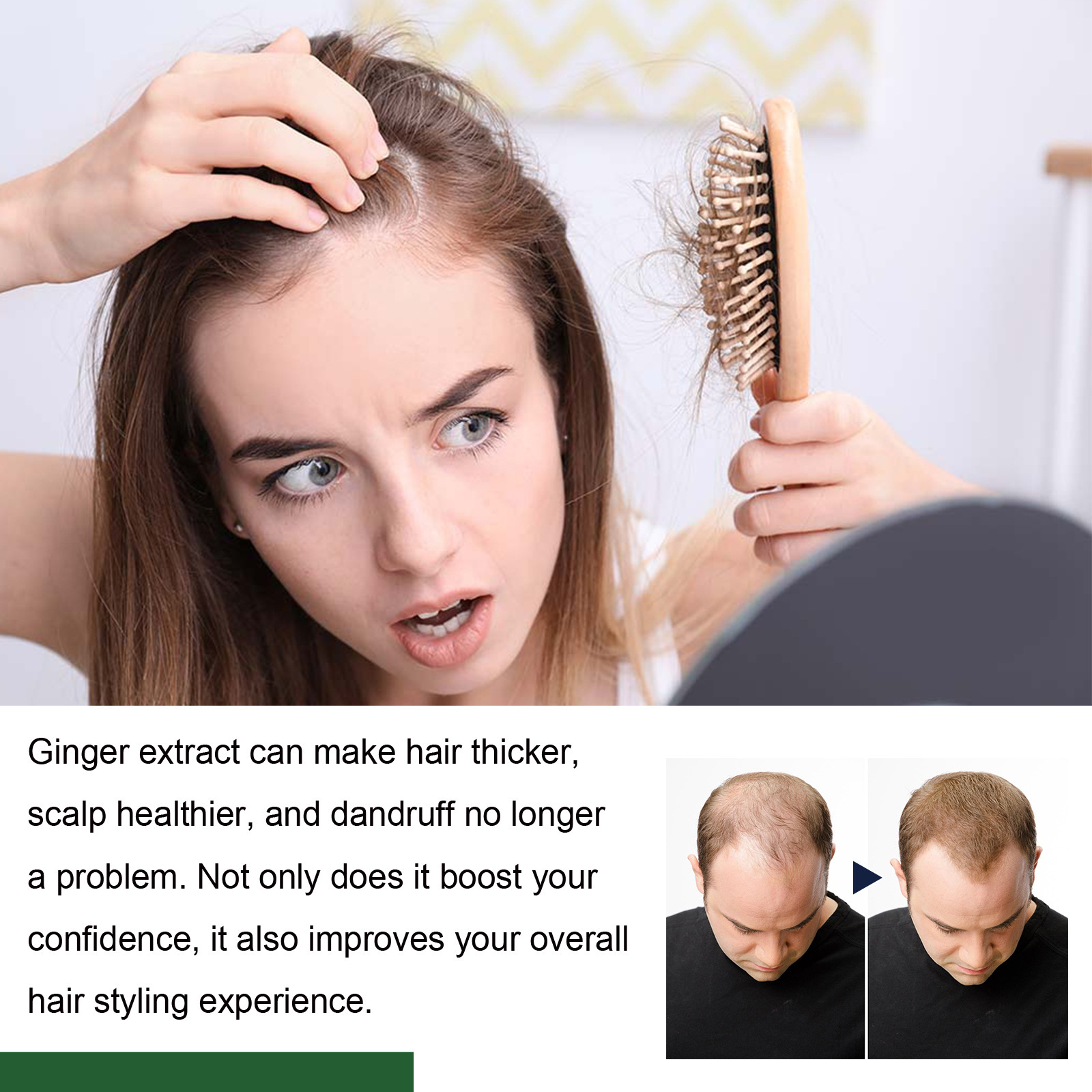 South Moon Ginger Series Kopfhautpflege – Reinigung, Pflege, Fixierung der Haarwurzeln und für dichtes Haar_voghion.com