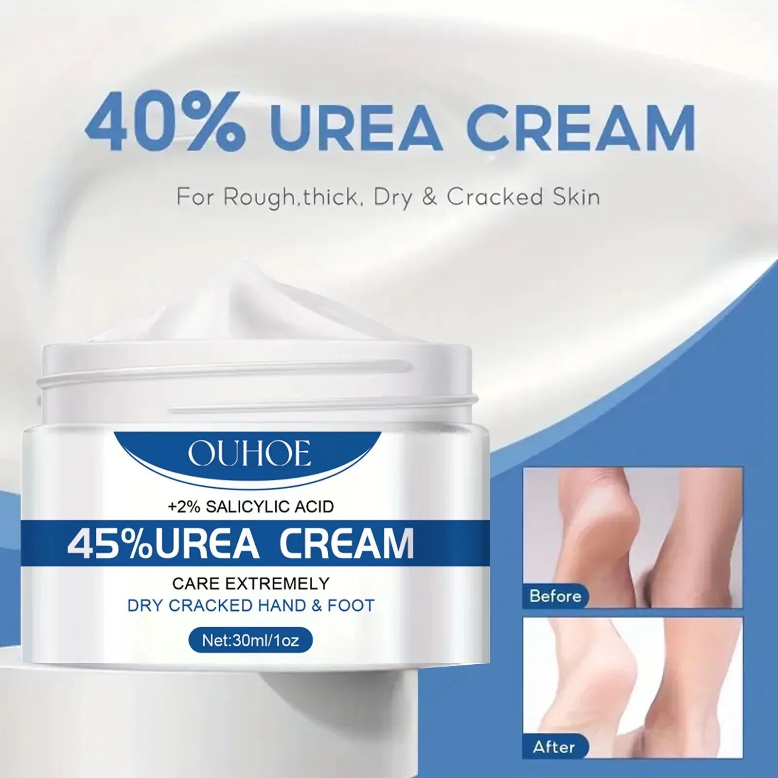 Anti Secchezza Crema Per I Piedi Urea Crepa Tallone Calli Rimozione Della Pelle Morta Lenitiva Screpolature Riparazione Idratante Idratazione Mano Piedi Cura_voghion.com