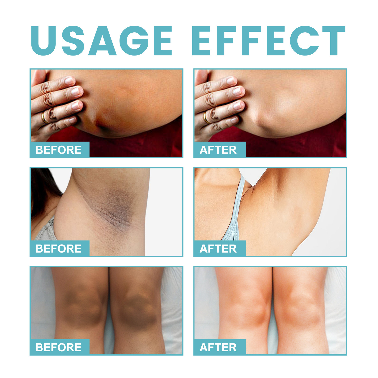 Ouhoe Whitening Milk For Body Underarm Knee And Joint Brightening_voghion.com