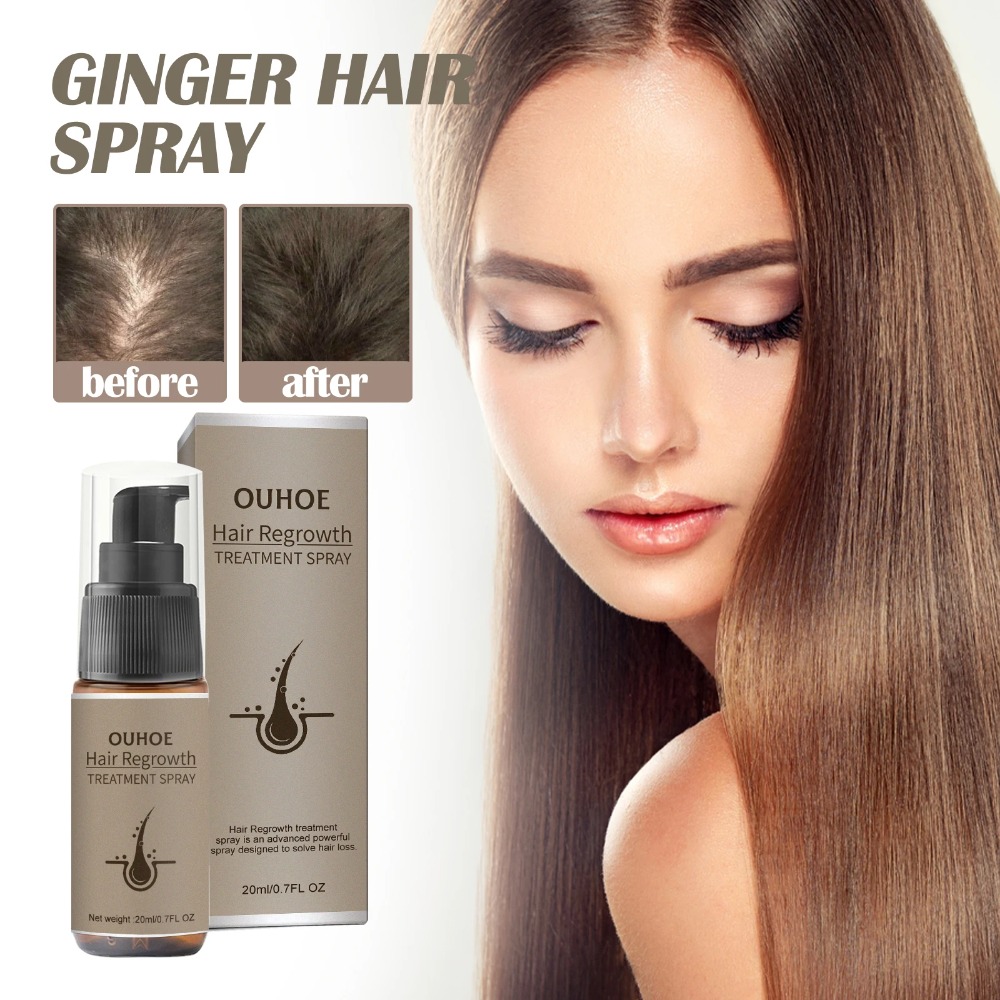 Leistungsstarkes Haarwuchs-Serum-Spray mit Ingwer, Anti-Haarausfall-Behandlungsprodukte, Reparatur, Pflege der Haarwurzeln, schnelles Nachwachsen der Haare bei Männern und Frauen_voghion.com
