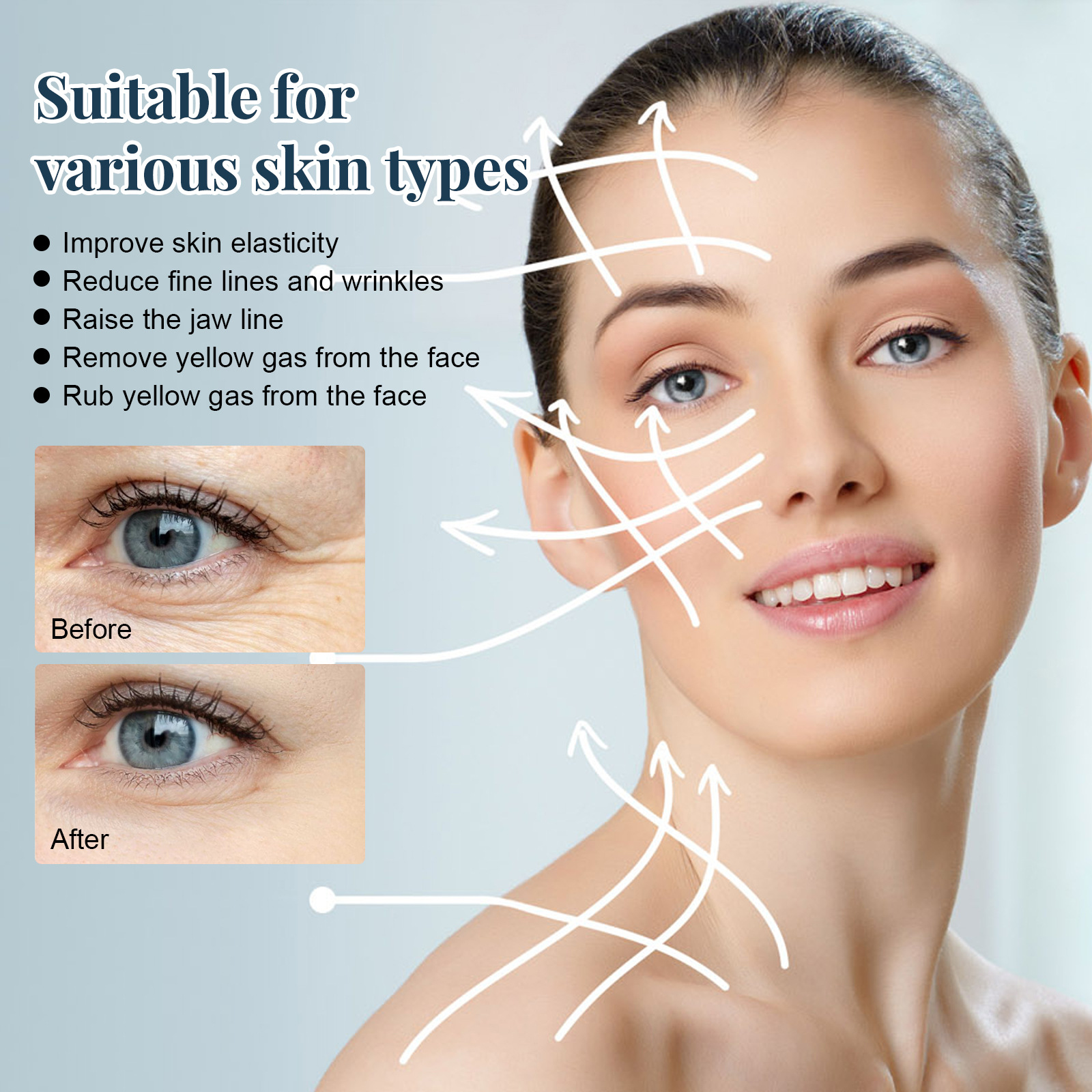 Linha de lifting de proteína EELHOE antirrugas para pele em V, lifting facial, firmeza, relaxamento dos contornos faciais, redução de medidas finas_voghion.com