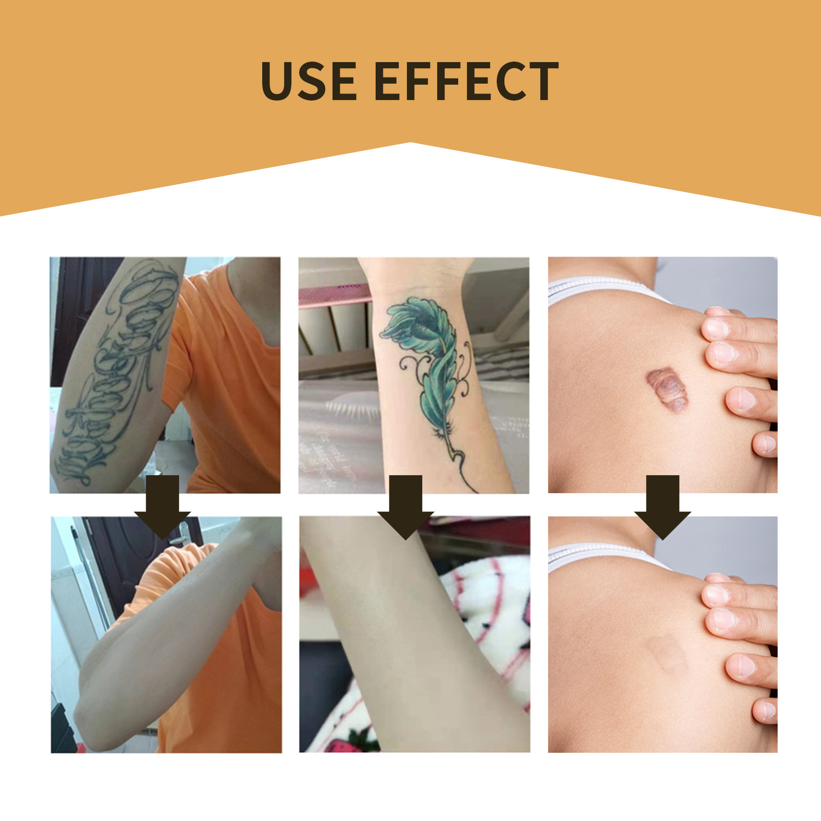 Jayswing tattoo scar concealer invisible waterproof skin color mask sticker_voghion.com