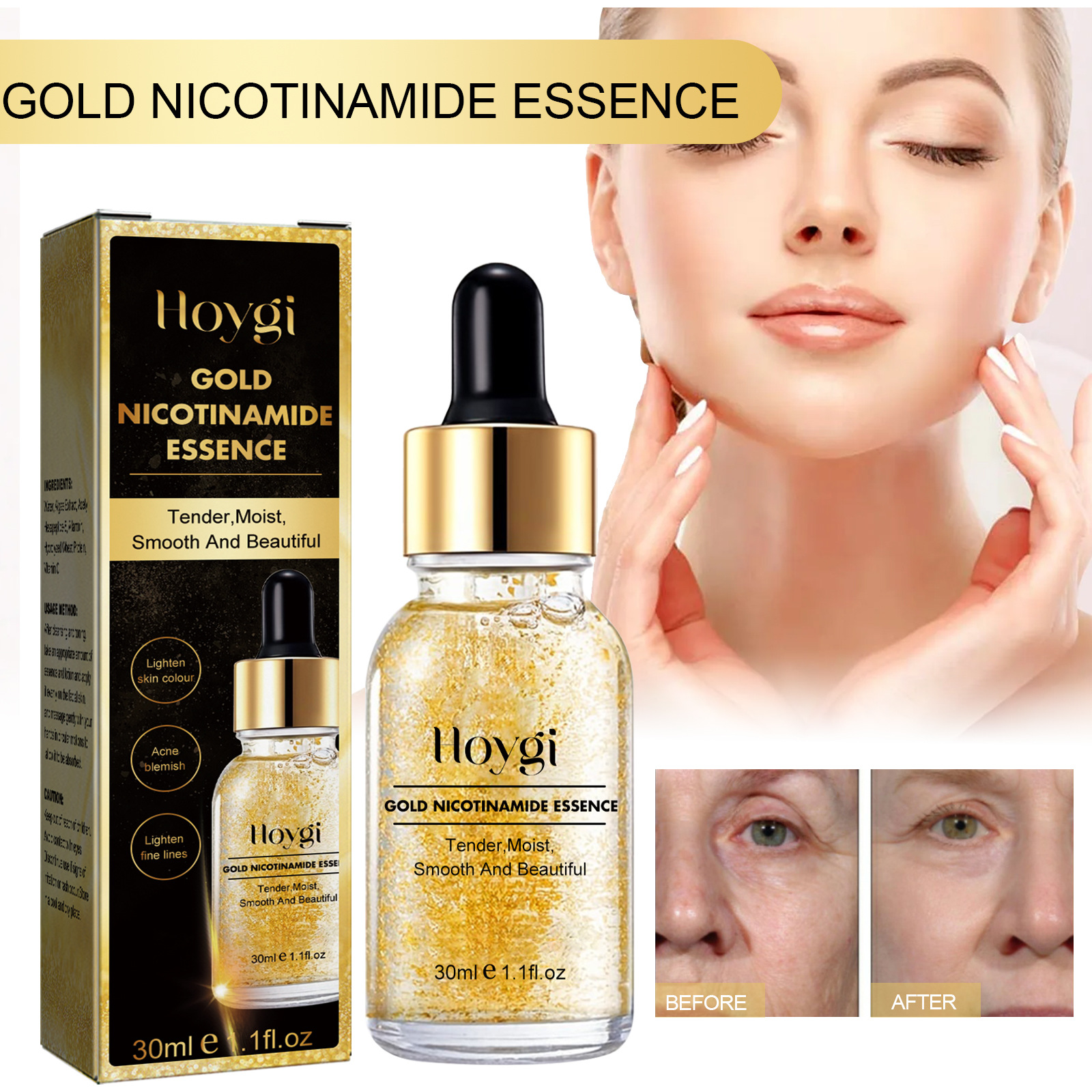 Hoygi Nicotinamide Essence kann Flecken und feine Linien aufhellen und stumpfe, weiße und zarte Haut reparieren._voghion.com
